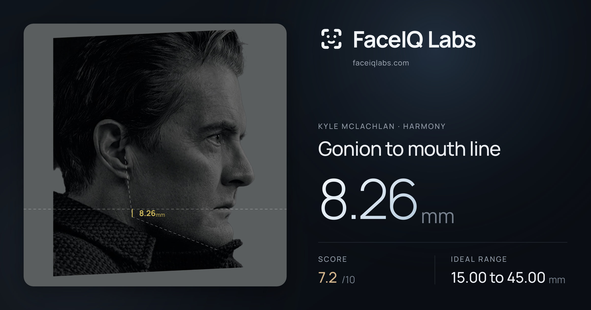 Kyle McLachlan Gonion to mouth line: 8.26mm, drawn on the photo