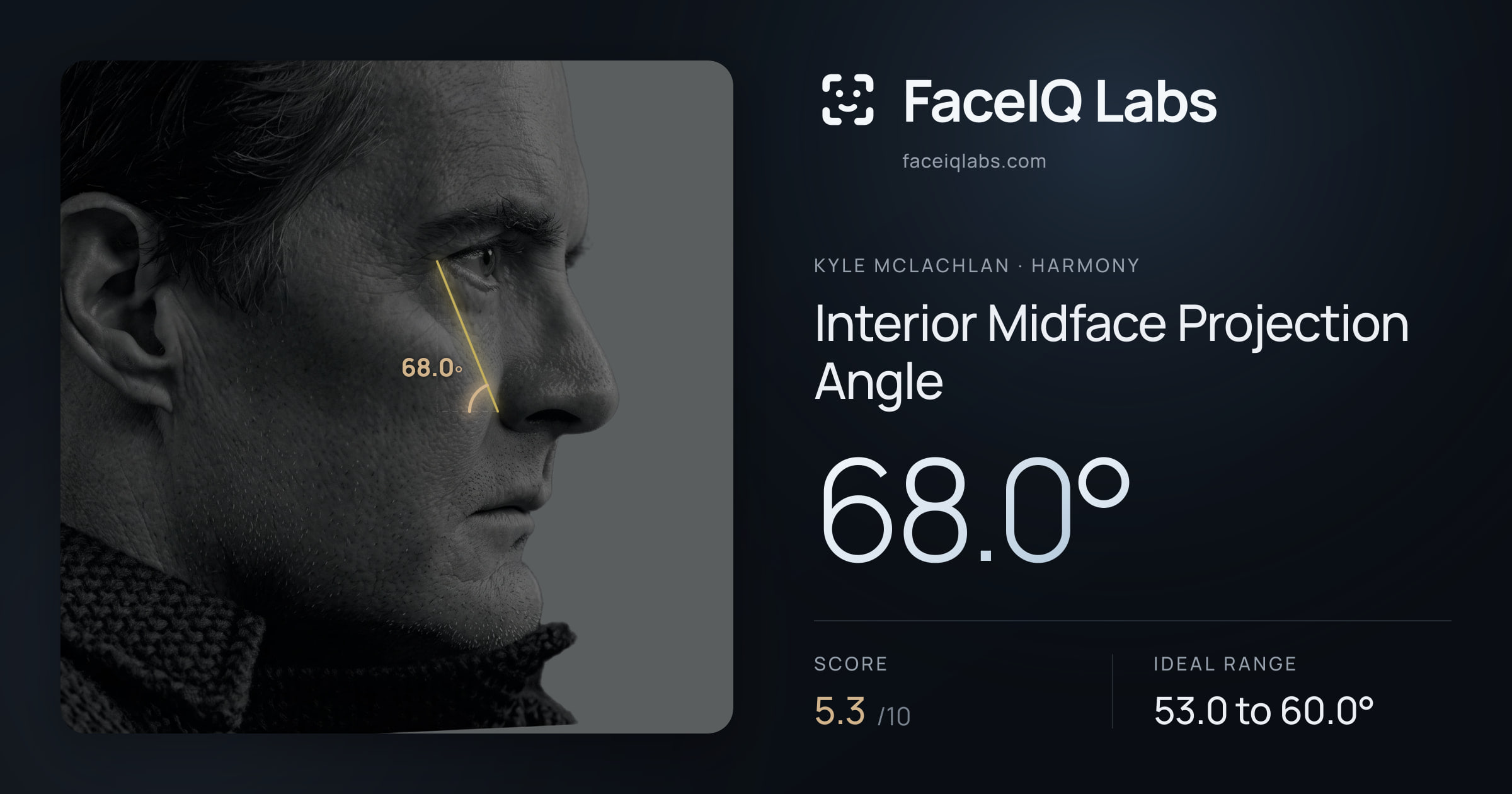 Kyle McLachlan Interior Midface Projection Angle: 68.0°, drawn on the photo