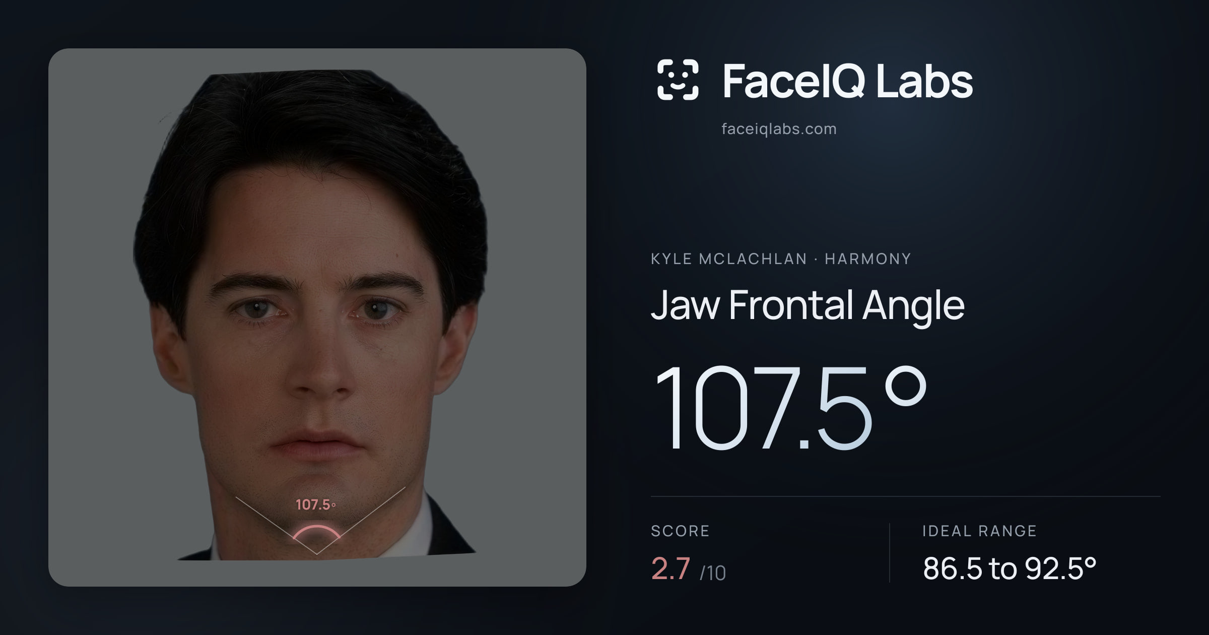 Kyle McLachlan Jaw Frontal Angle: 107.5°, drawn on the photo