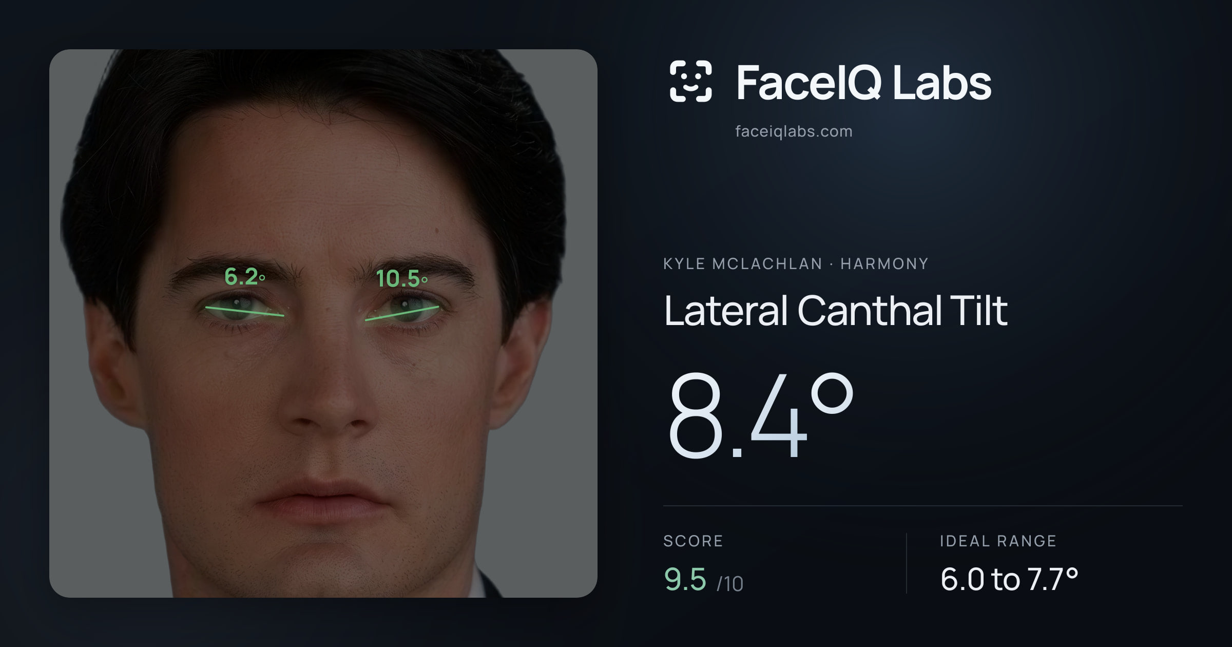 Kyle McLachlan Lateral Canthal Tilt: 8.4°, drawn on the photo