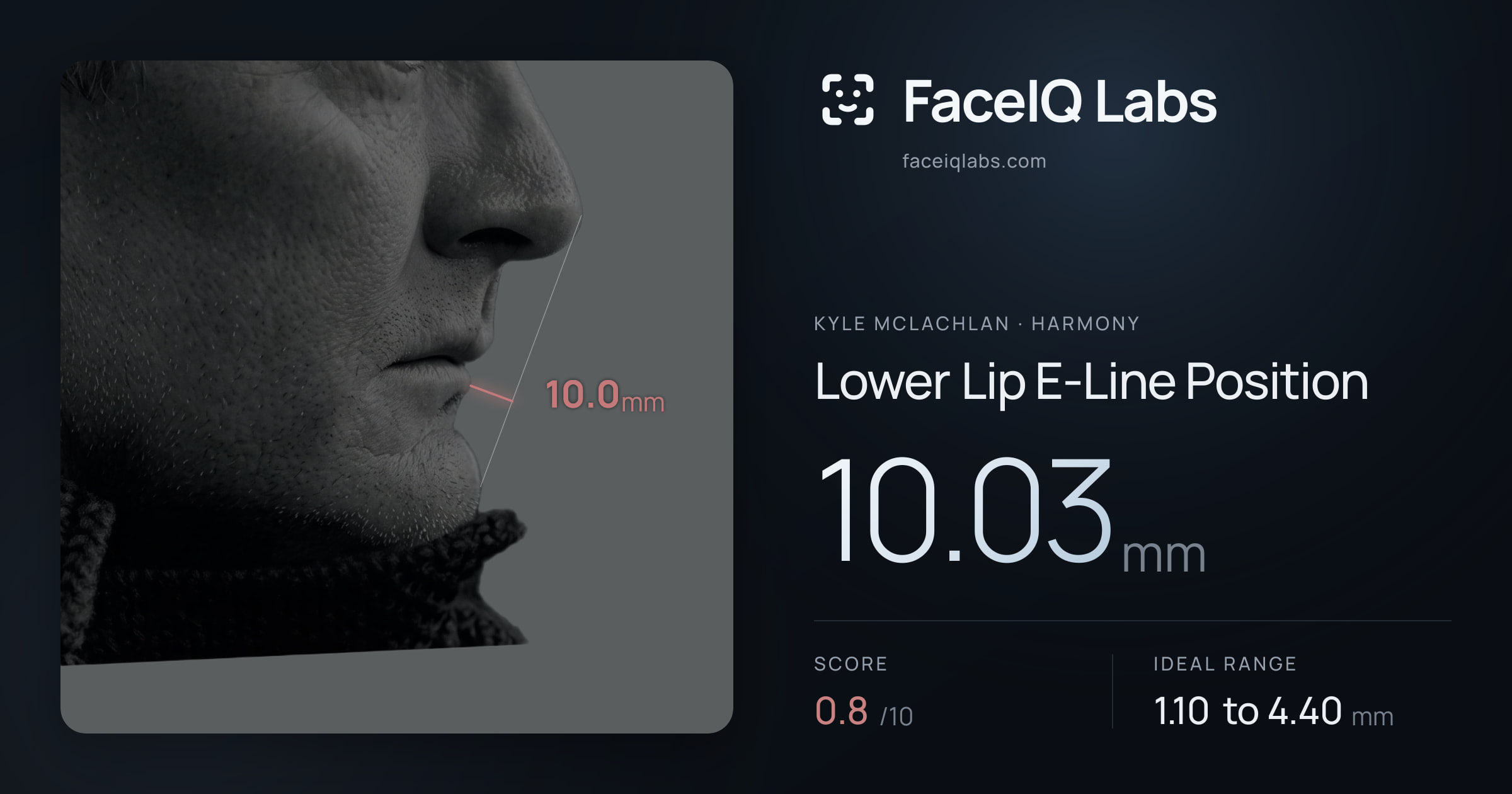 Kyle McLachlan Lower Lip E-Line Position: 10.03mm, drawn on the photo