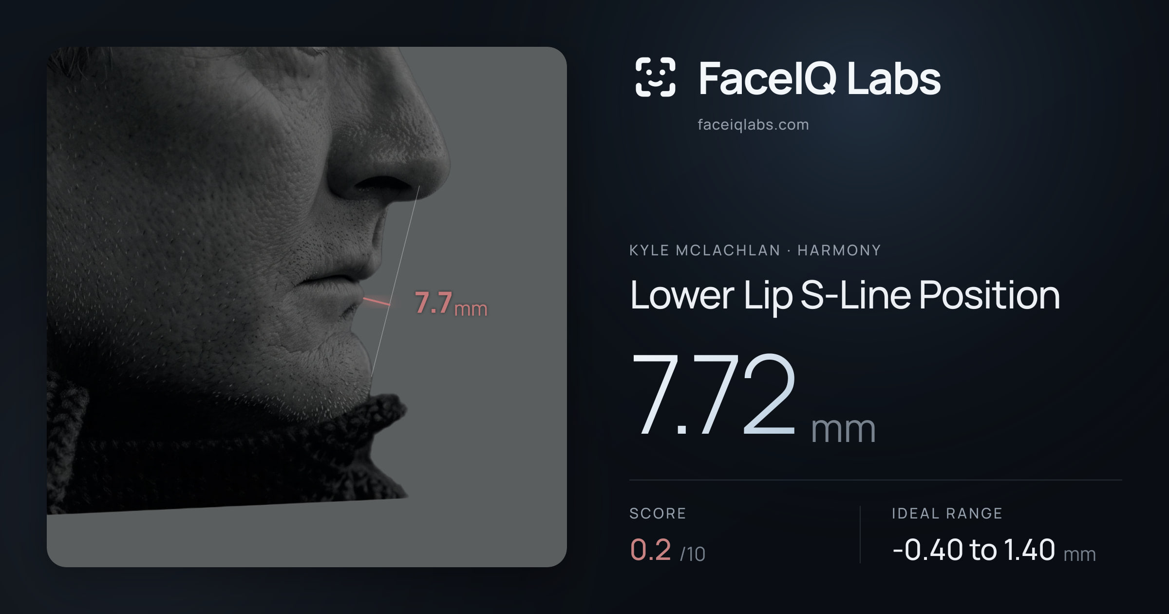 Kyle McLachlan Lower Lip S-Line Position: 7.72mm, drawn on the photo