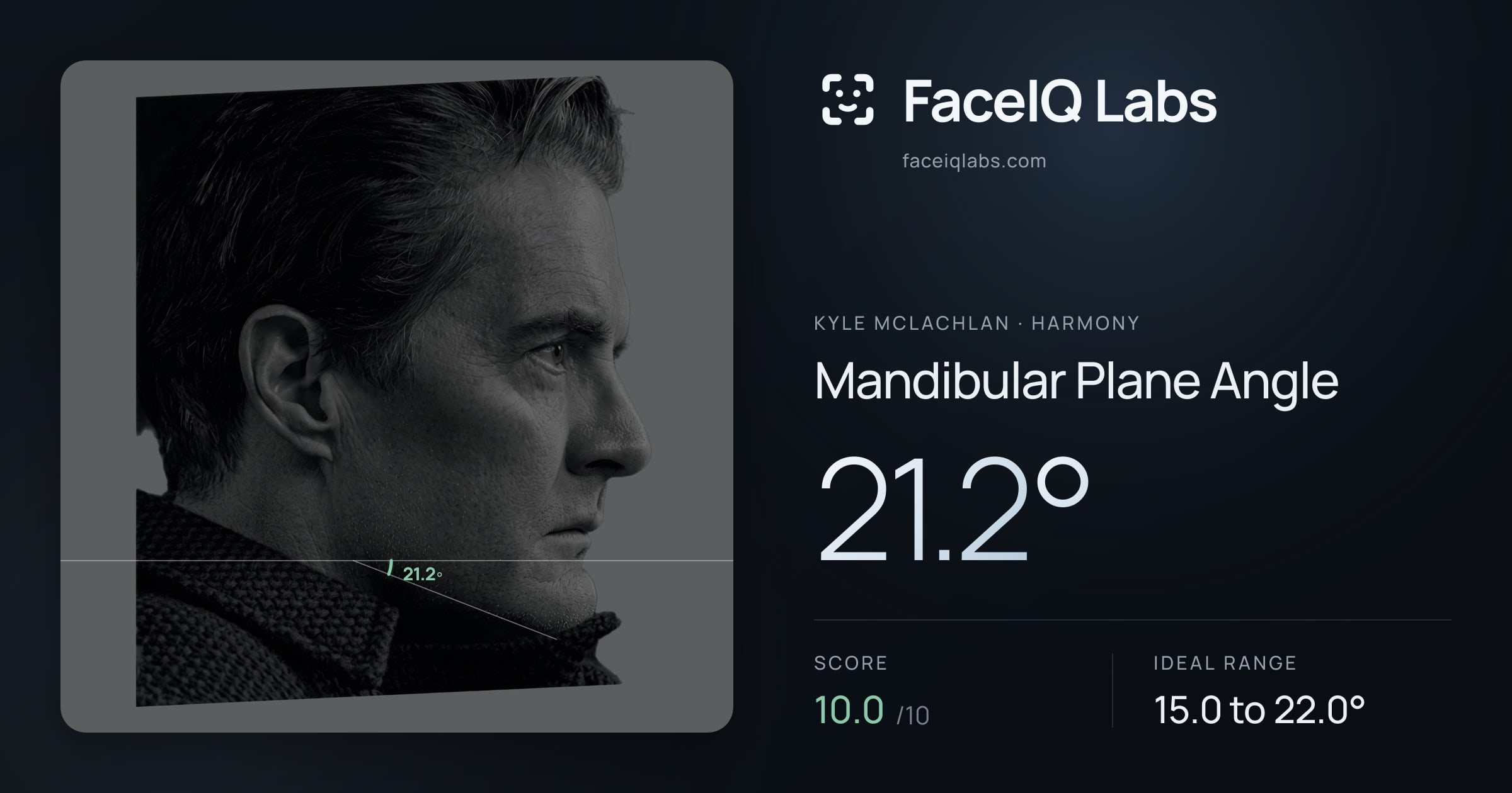 Kyle McLachlan Mandibular Plane Angle: 21.2°, drawn on the photo