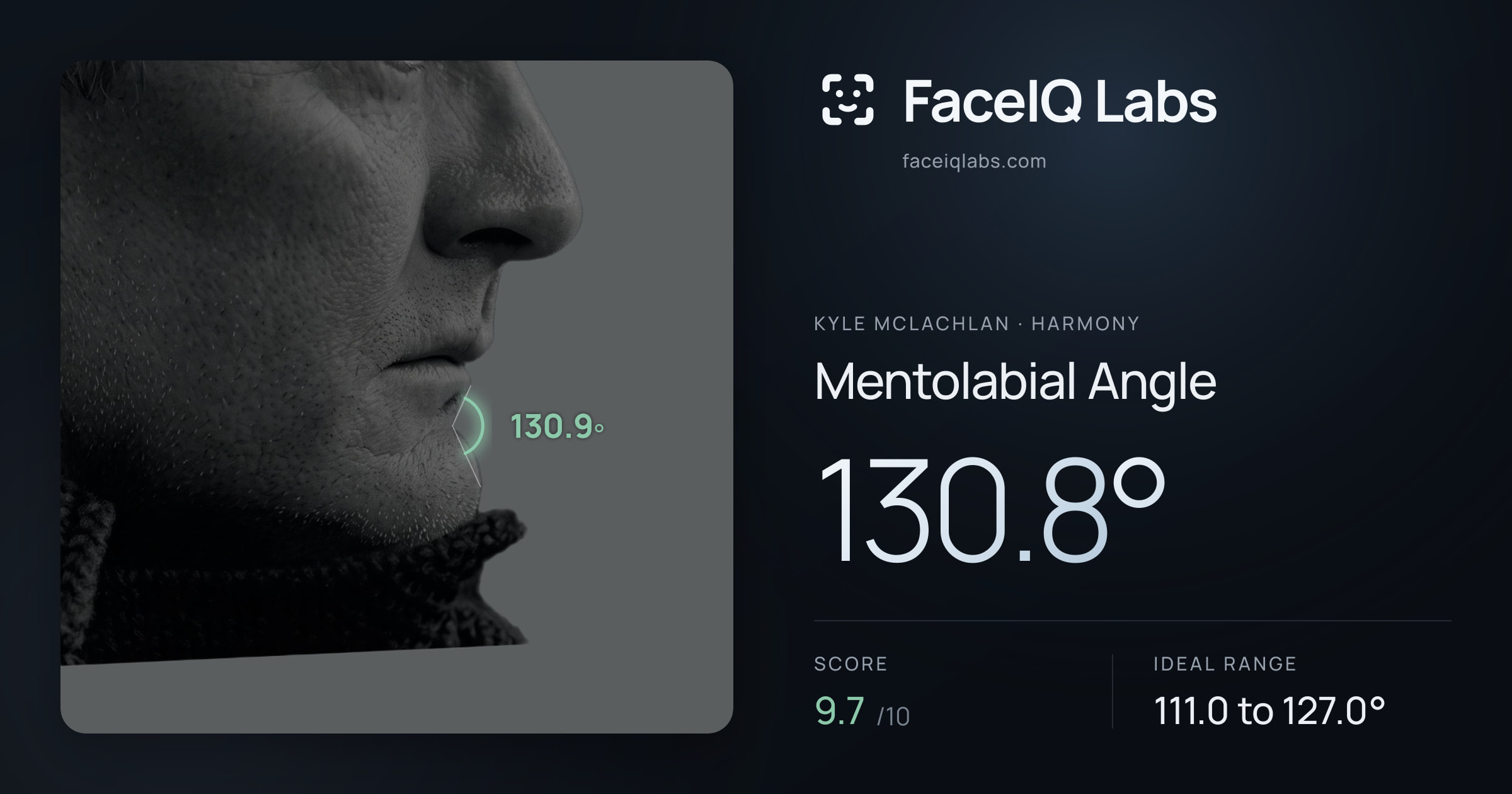 Kyle McLachlan Mentolabial Angle: 130.8°, drawn on the photo