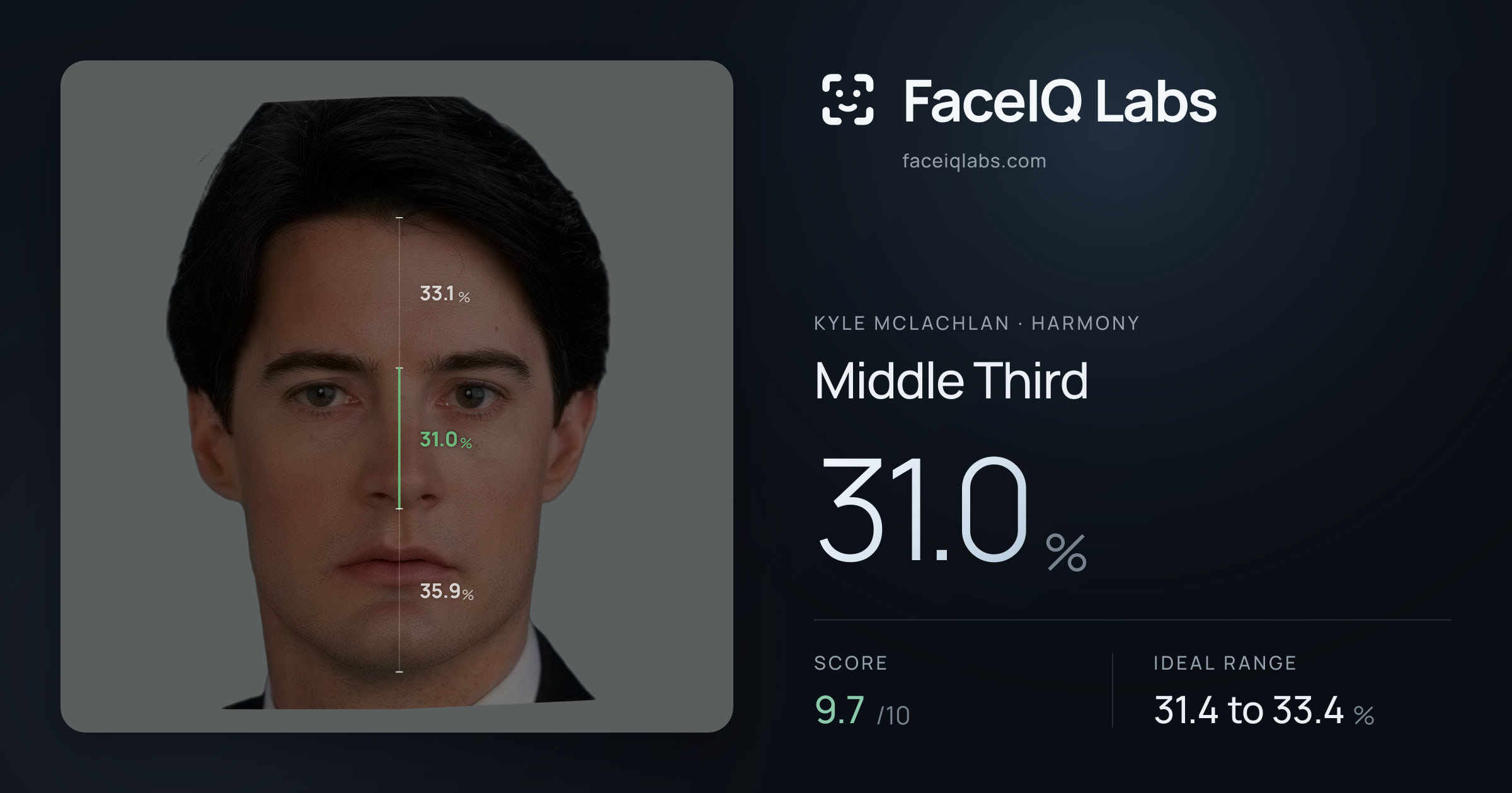 Kyle McLachlan Middle Third: 31.0%, drawn on the photo