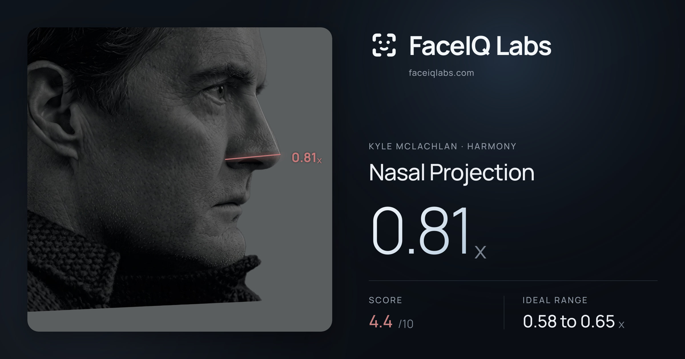 Kyle McLachlan Nasal Projection: 0.81x, drawn on the photo