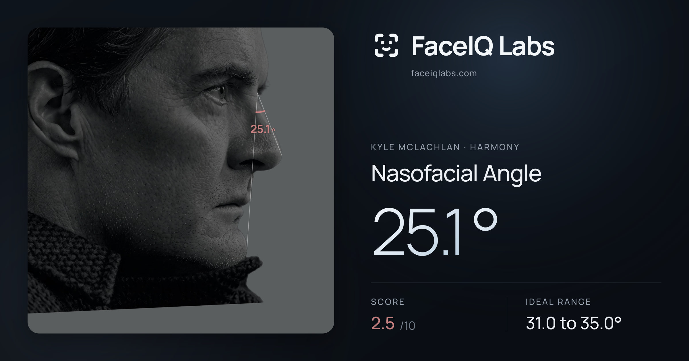 Kyle McLachlan Nasofacial Angle: 25.1°, drawn on the photo