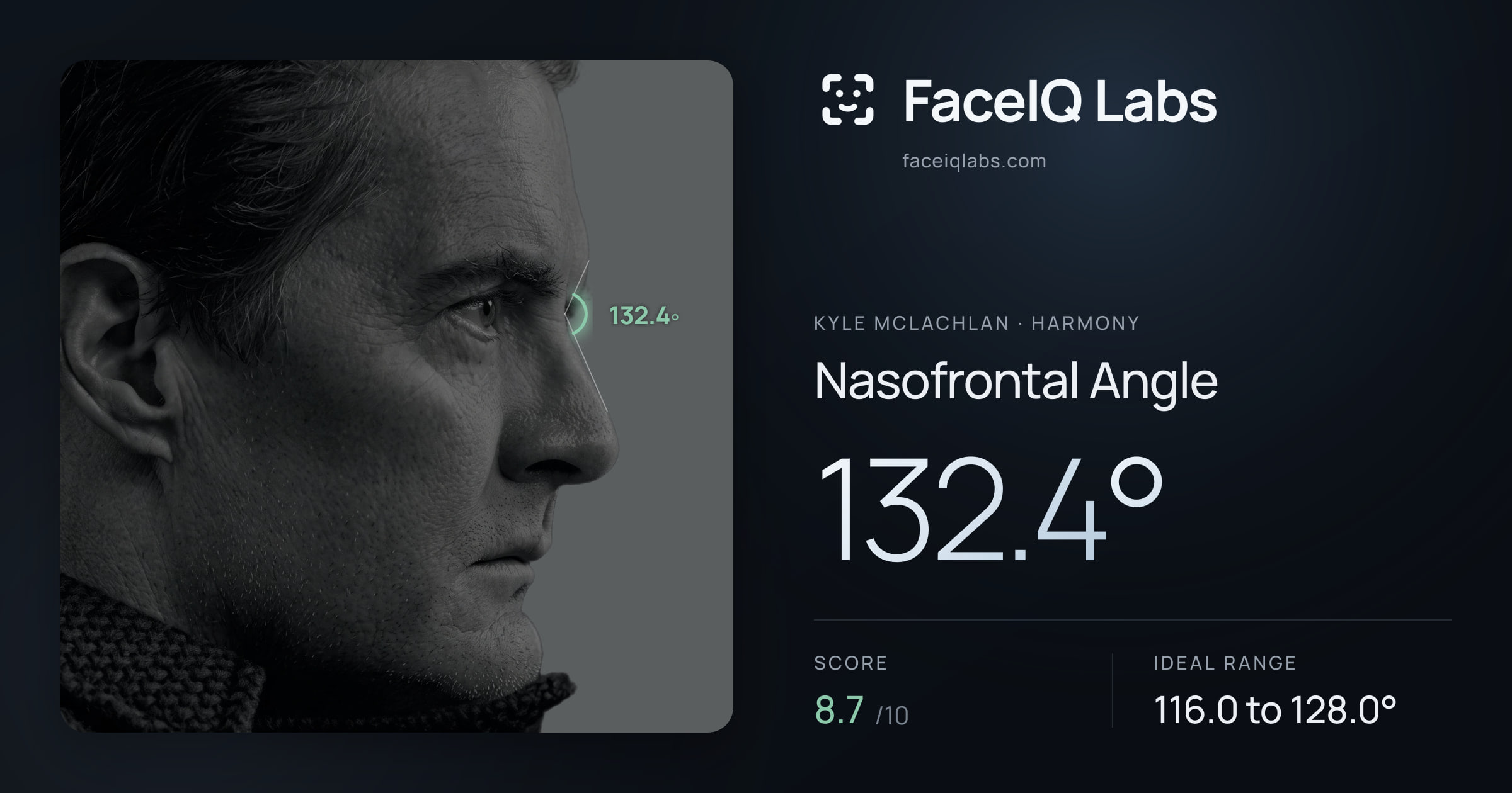 Kyle McLachlan Nasofrontal Angle: 132.4°, drawn on the photo