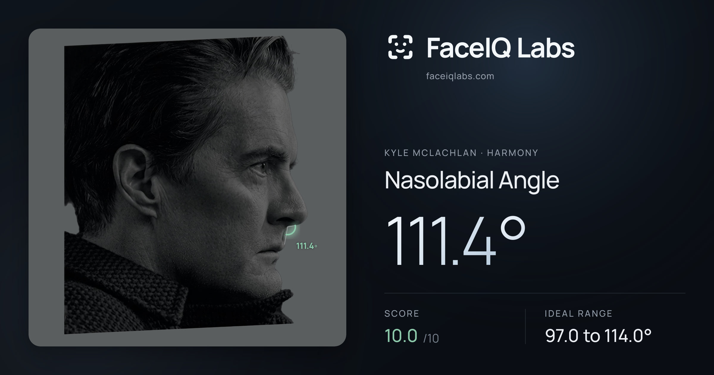Kyle McLachlan Nasolabial Angle: 111.4°, drawn on the photo