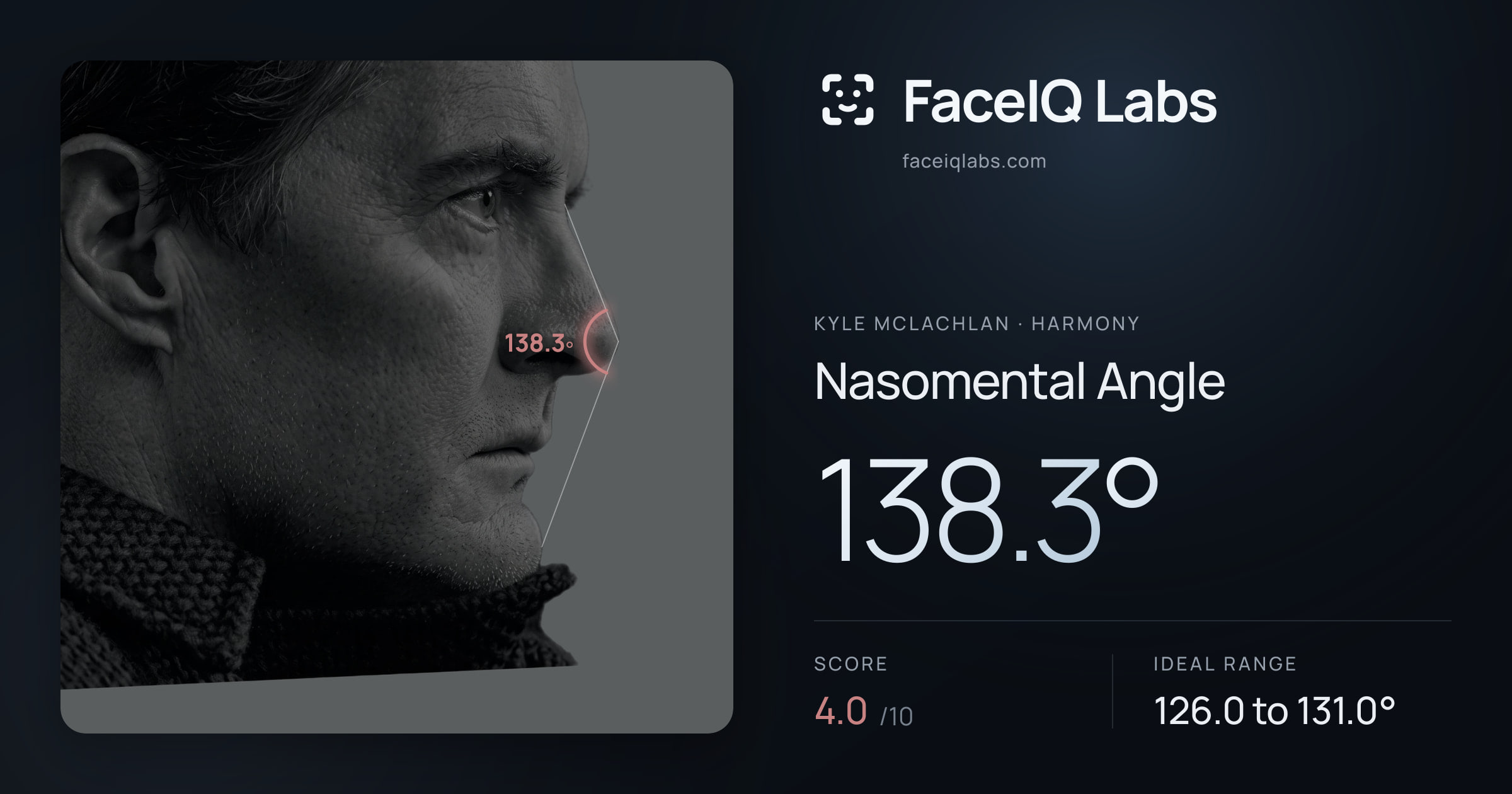 Kyle McLachlan Nasomental Angle: 138.3°, drawn on the photo