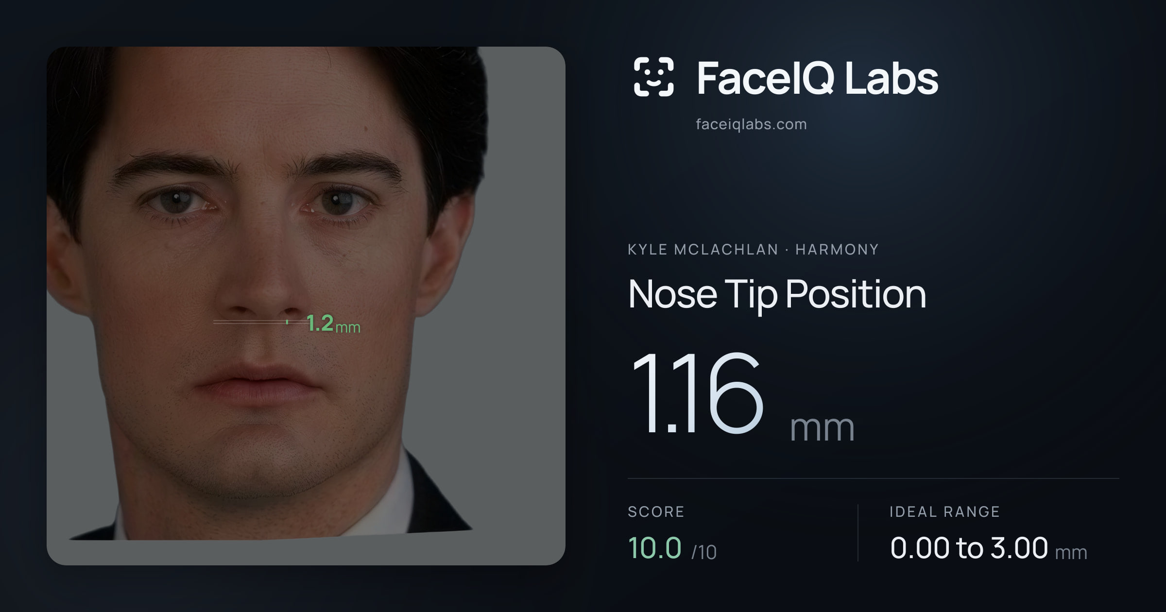 Kyle McLachlan Nose Tip Position: 1.16mm, drawn on the photo