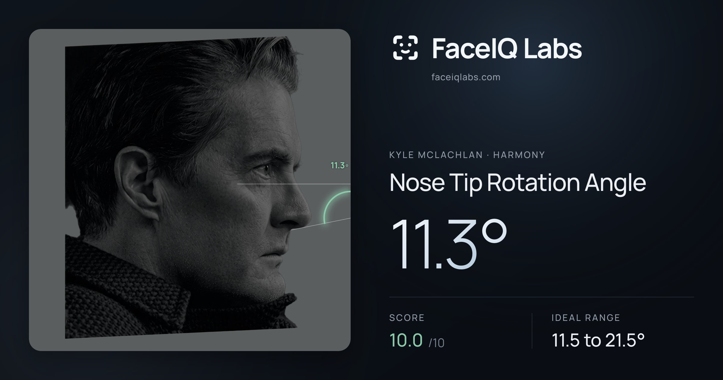Kyle McLachlan Nose Tip Rotation Angle: 11.3°, drawn on the photo