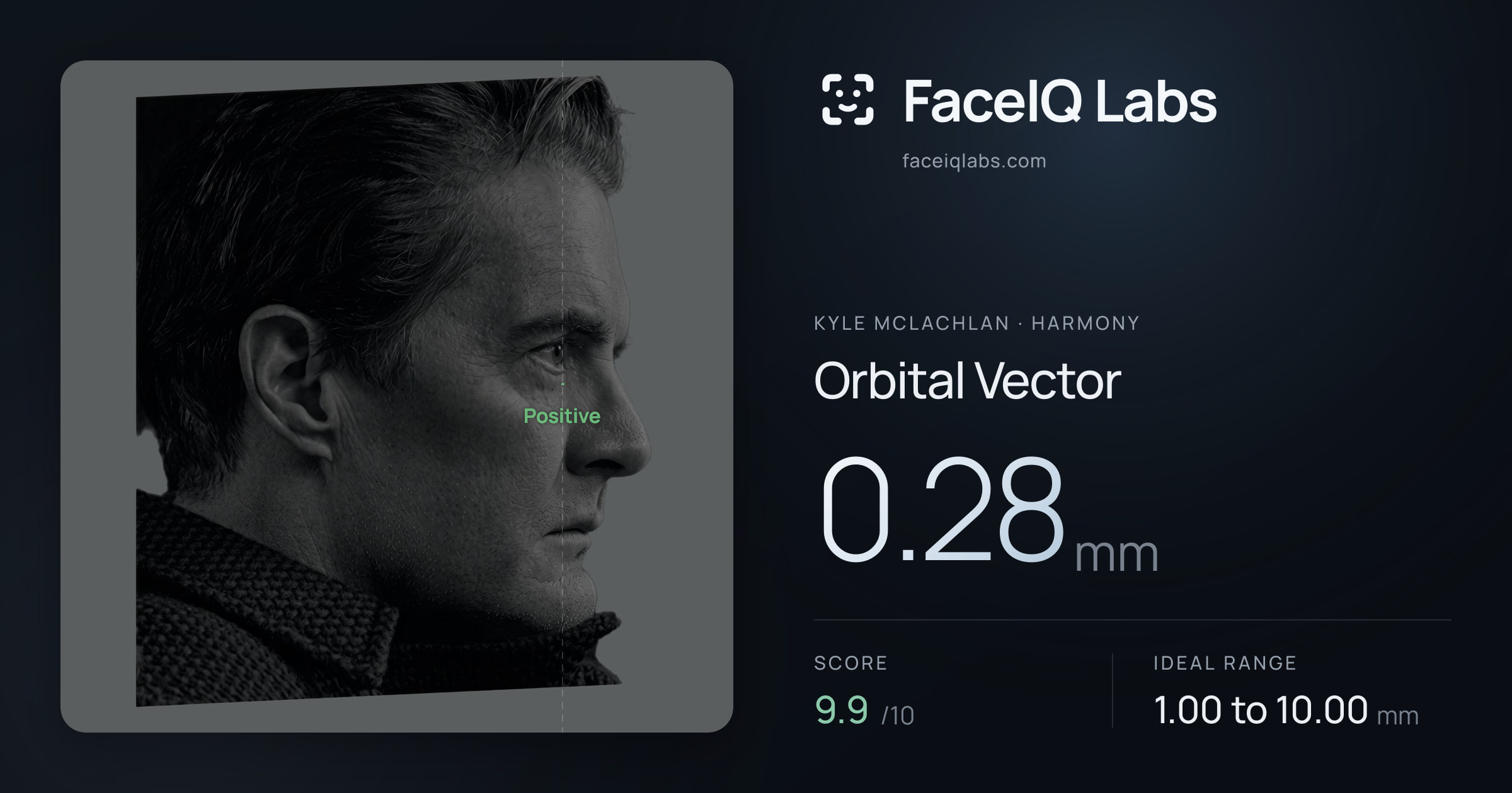 Kyle McLachlan Orbital Vector: 0.28mm, drawn on the photo