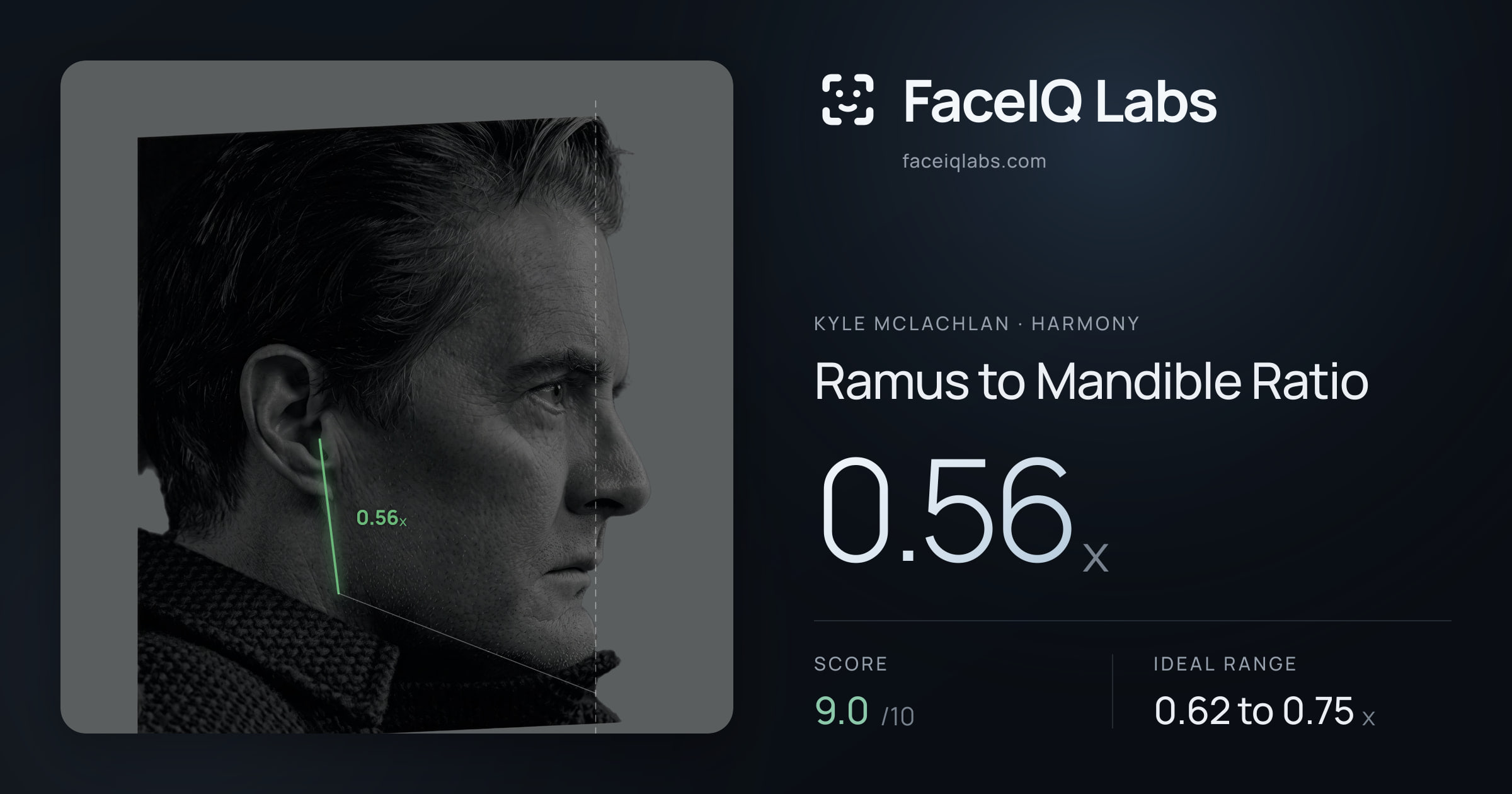 Kyle McLachlan Ramus to Mandible Ratio: 0.56x, drawn on the photo