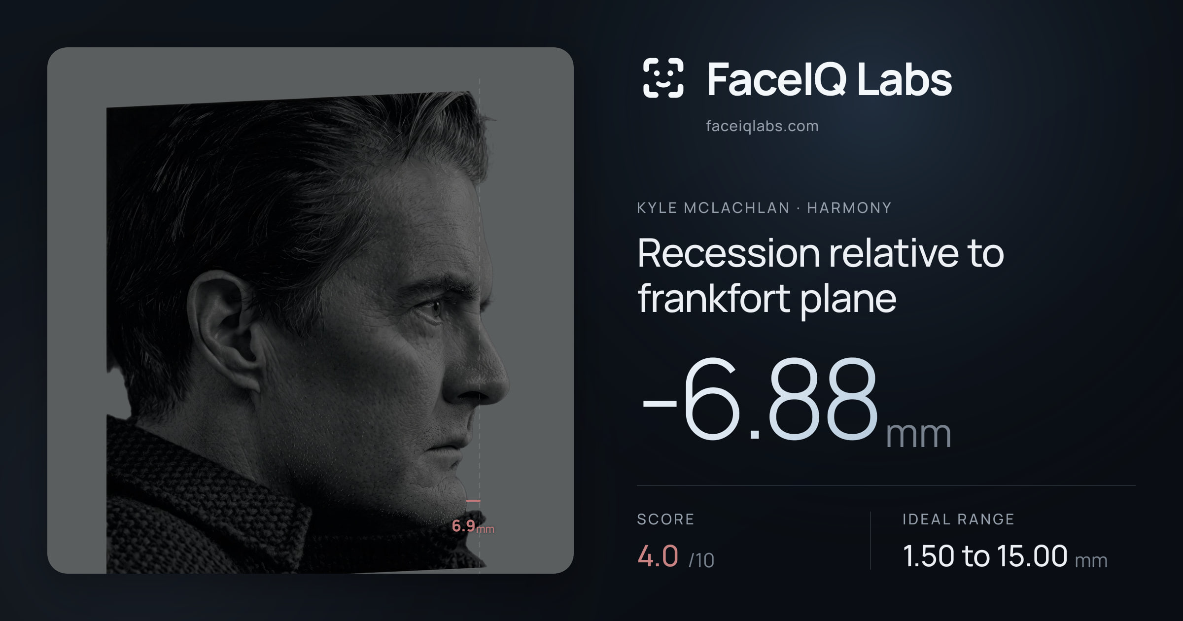 Kyle McLachlan Recession relative to frankfort plane: -6.88mm, drawn on the photo