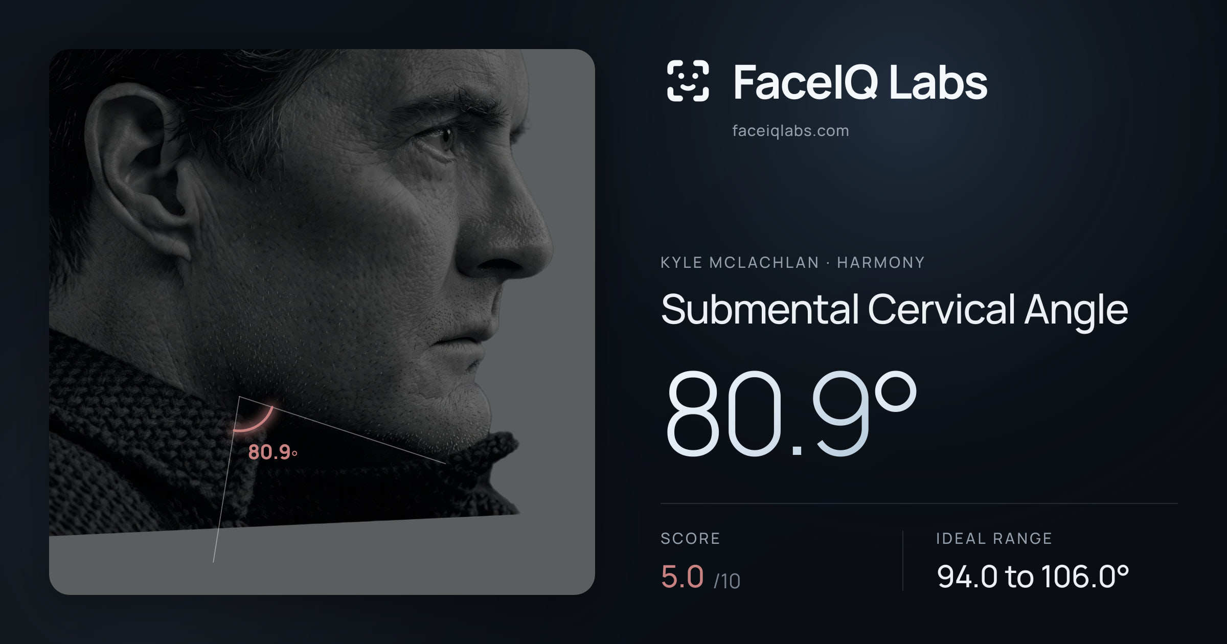 Kyle McLachlan Submental Cervical Angle: 80.9°, drawn on the photo