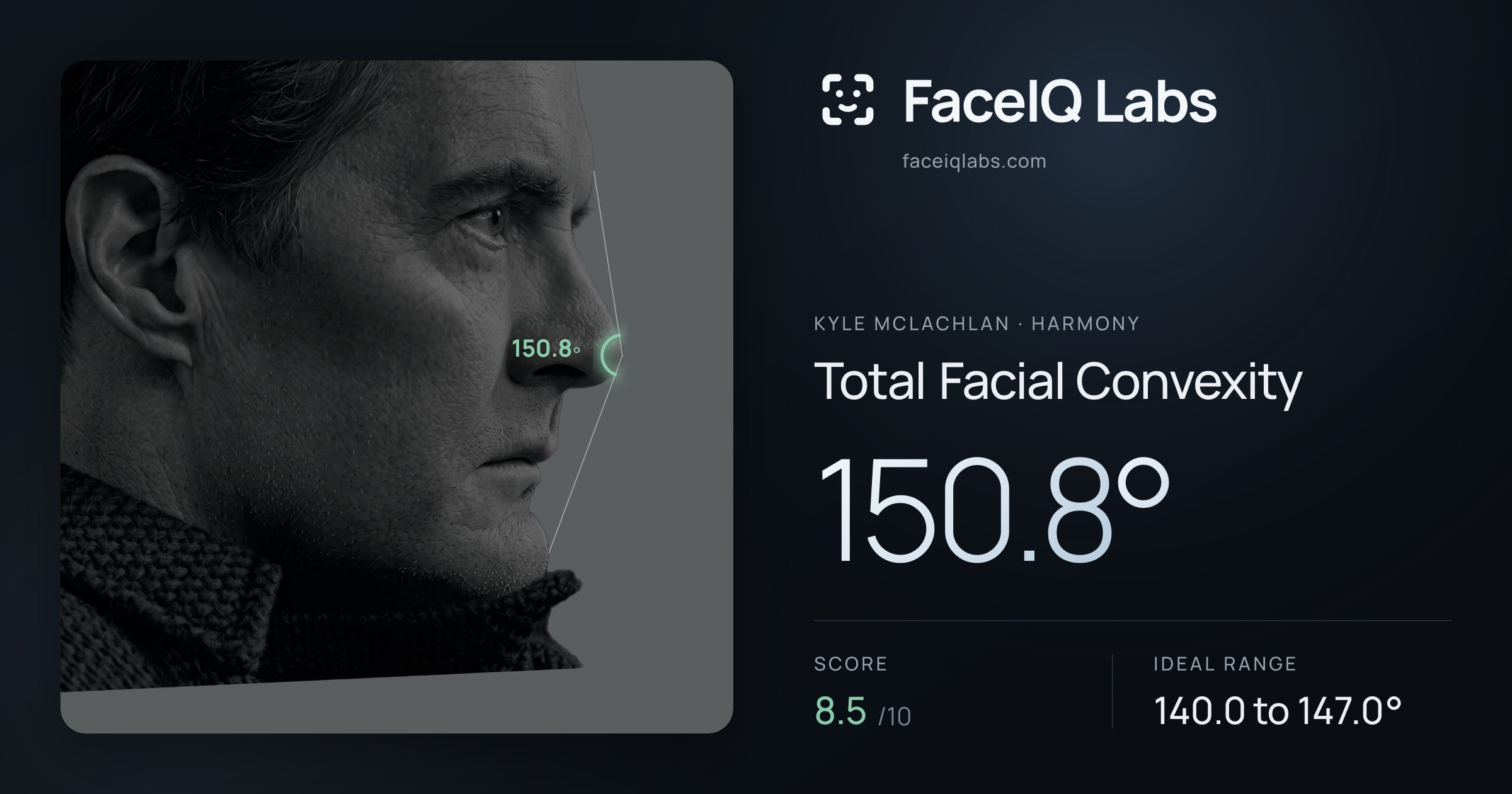 Kyle McLachlan Total Facial Convexity: 150.8°, drawn on the photo