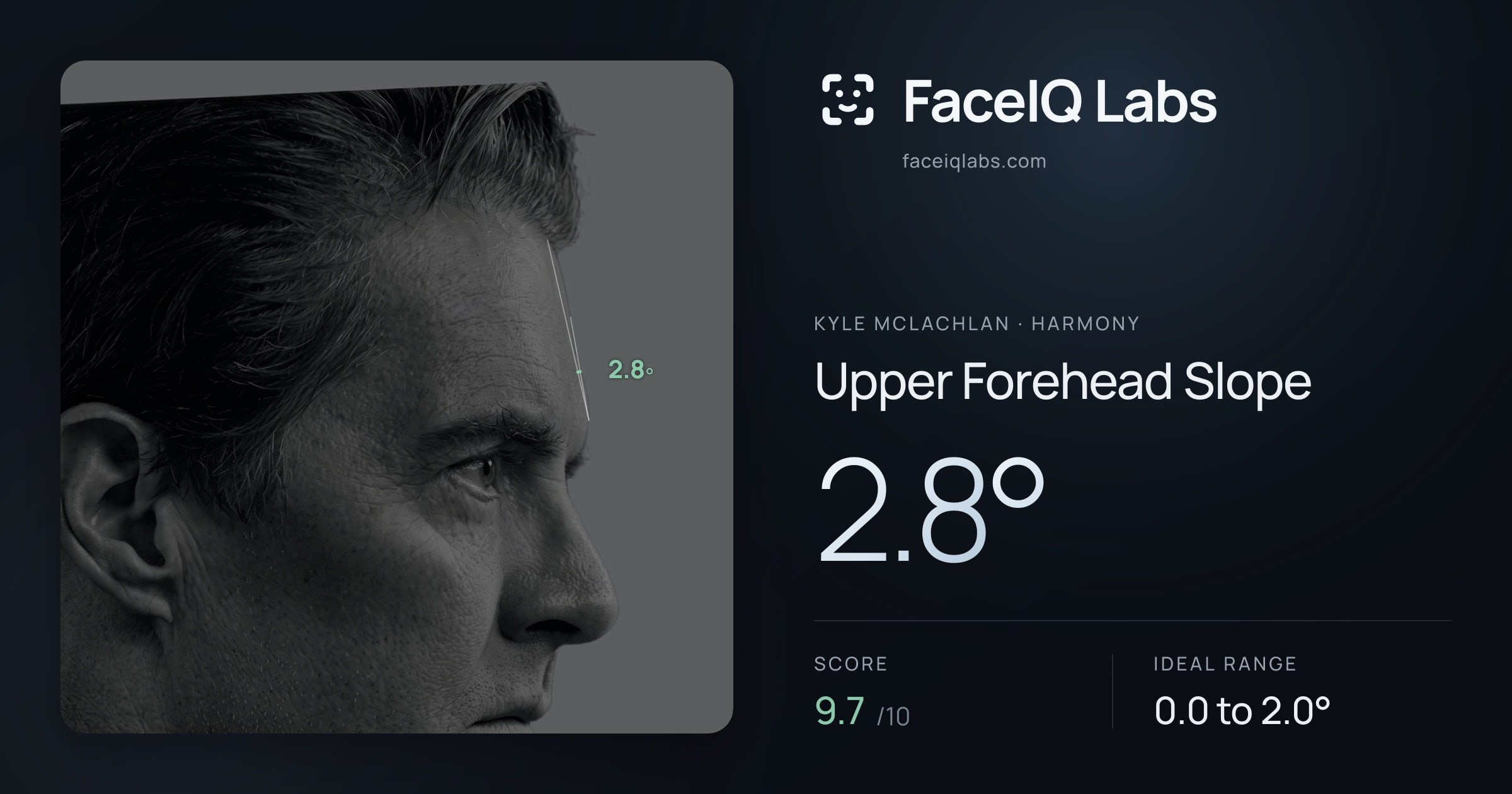 Kyle McLachlan Upper Forehead Slope: 2.8°, drawn on the photo