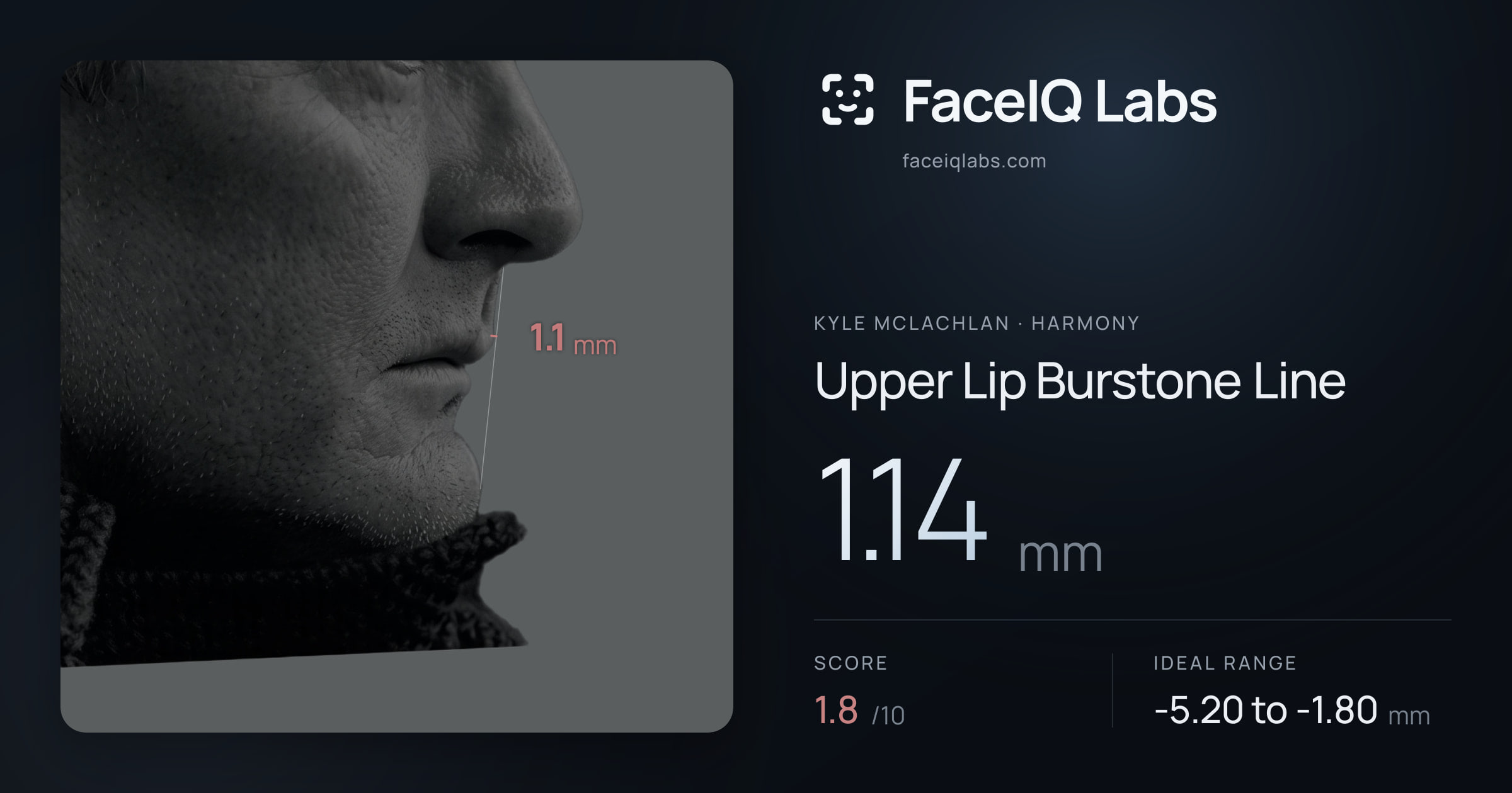 Kyle McLachlan Upper Lip Burstone Line: 1.14mm, drawn on the photo