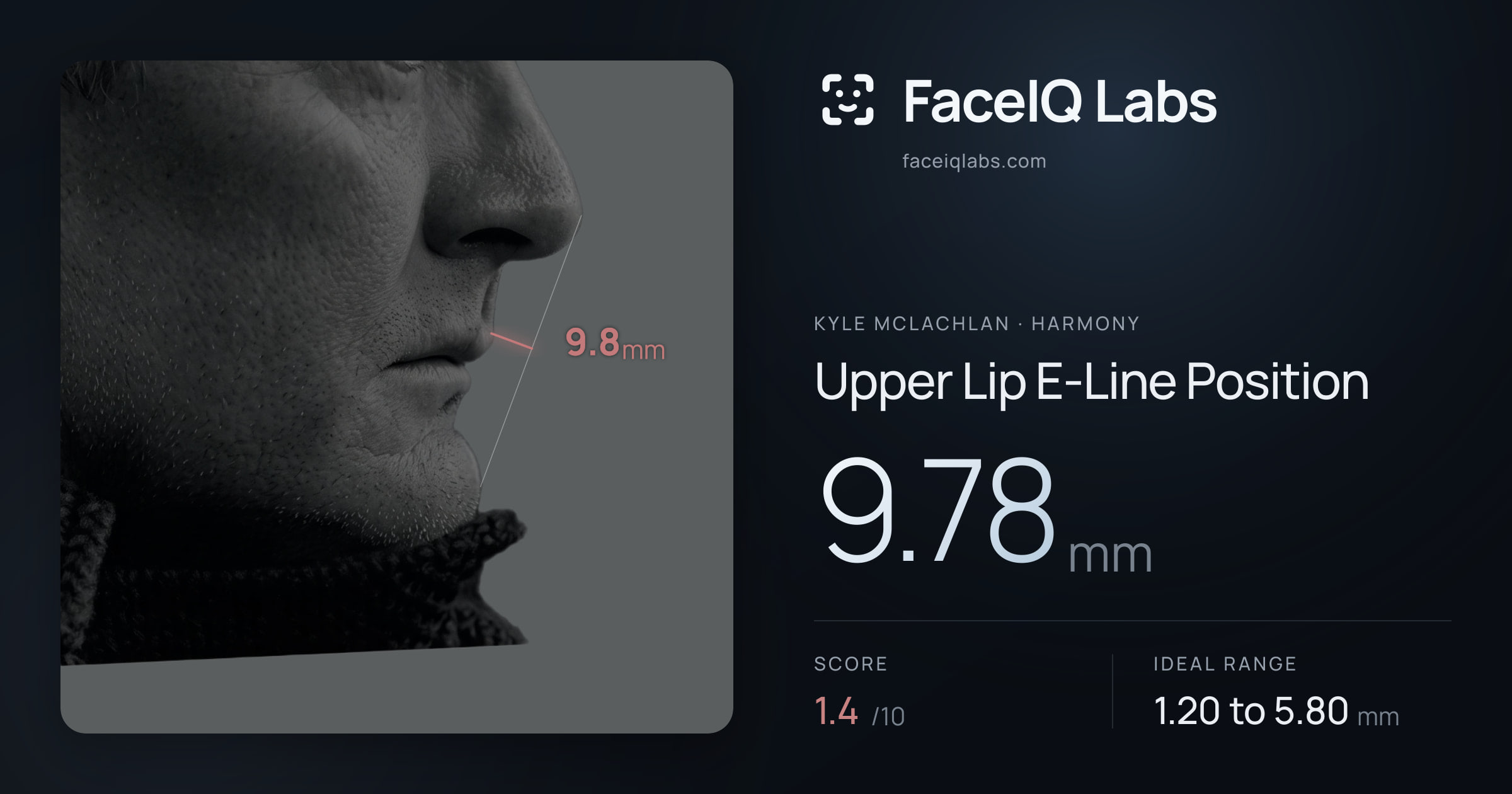 Kyle McLachlan Upper Lip E-Line Position: 9.78mm, drawn on the photo