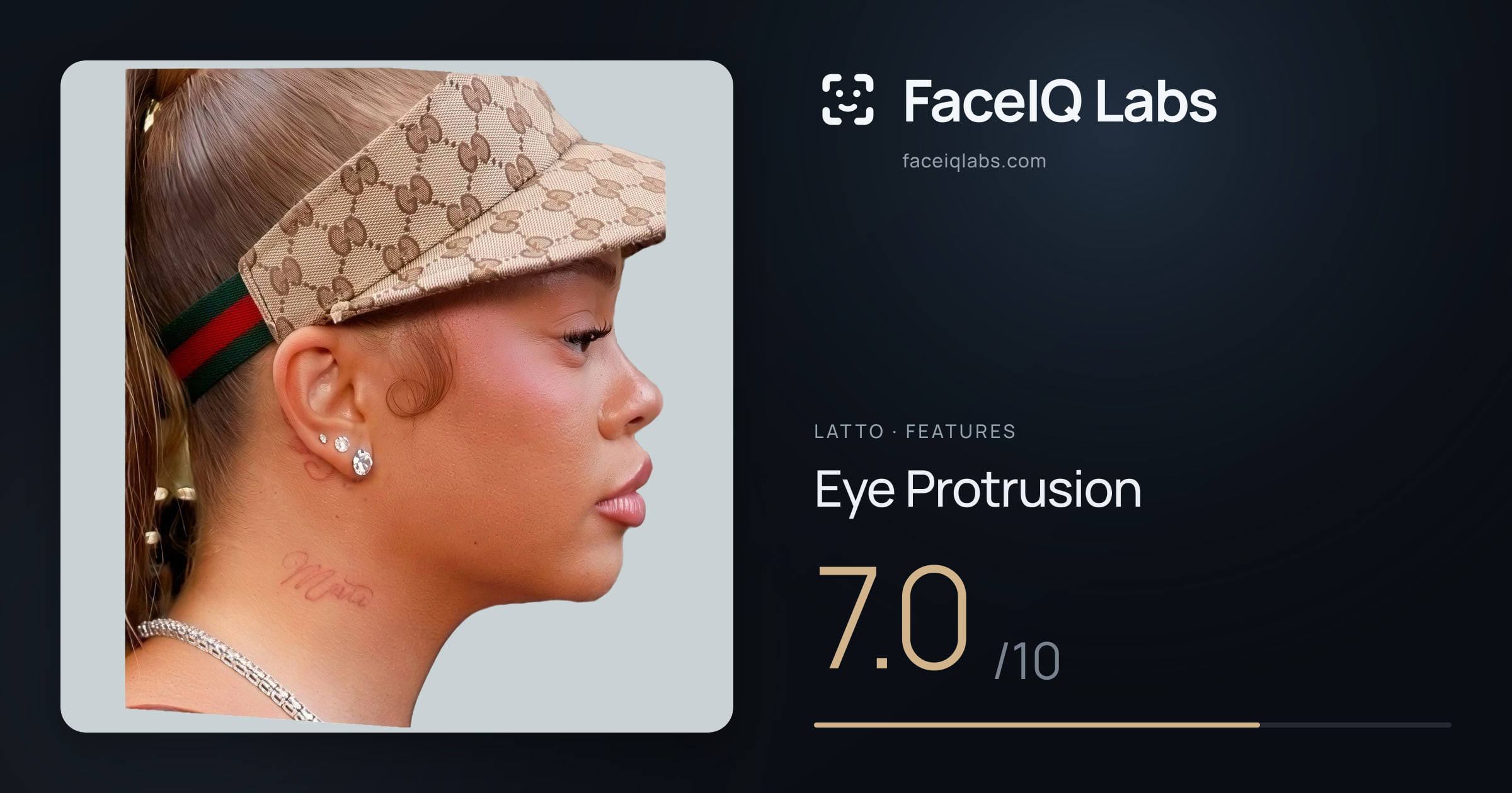 Latto Eye Protrusion: 7.0/10, drawn on the photo