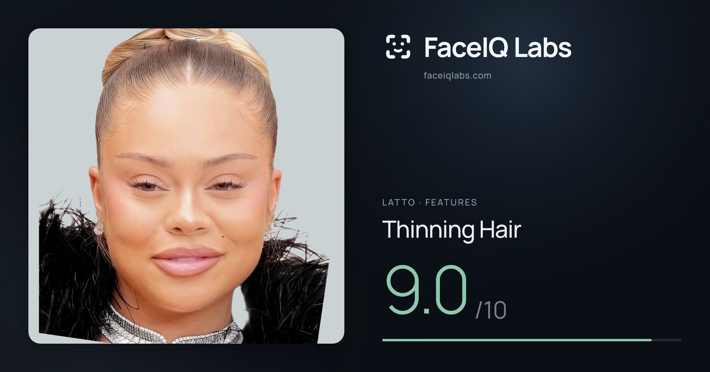 Latto Thinning Hair: 9.0/10, drawn on the photo