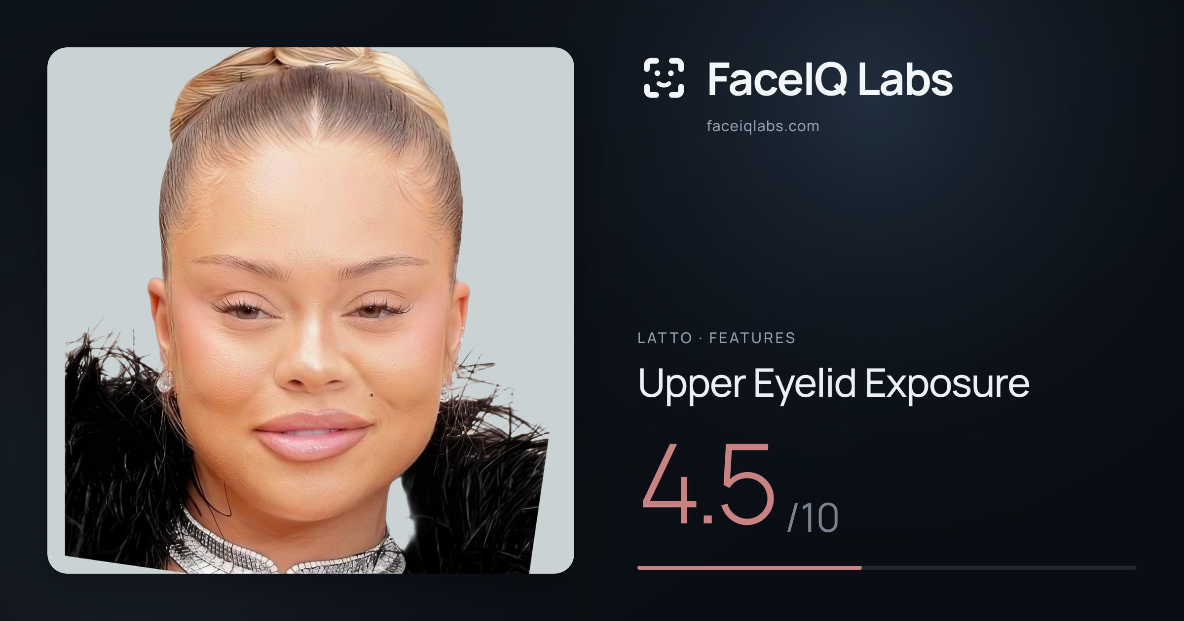 Latto Upper Eyelid Exposure: 4.5/10, drawn on the photo