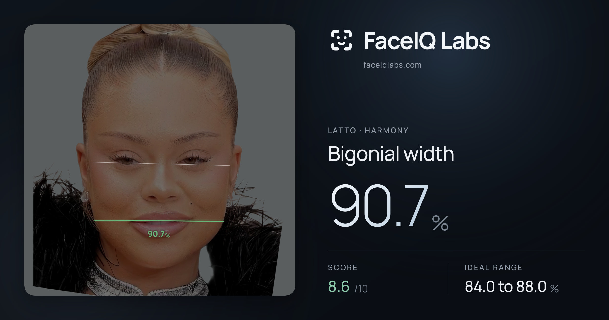 Latto Bigonial width: 90.7%, drawn on the photo