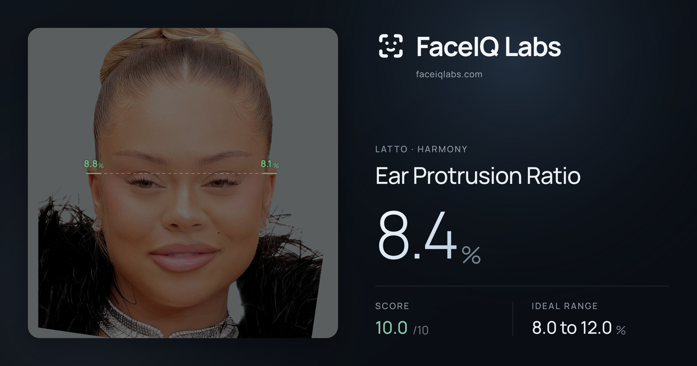 Latto Ear Protrusion Ratio: 8.4%, drawn on the photo