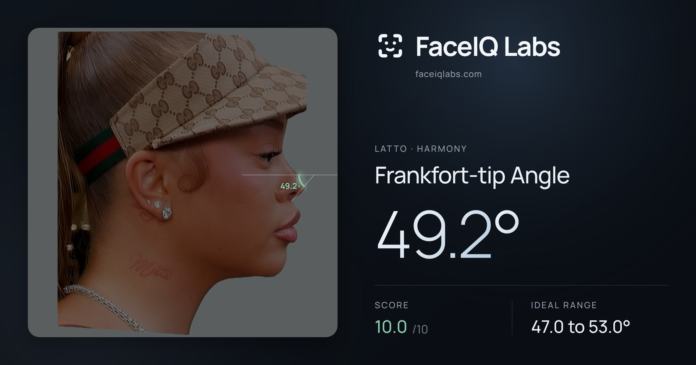 Latto Frankfort-tip Angle: 49.2°, drawn on the photo