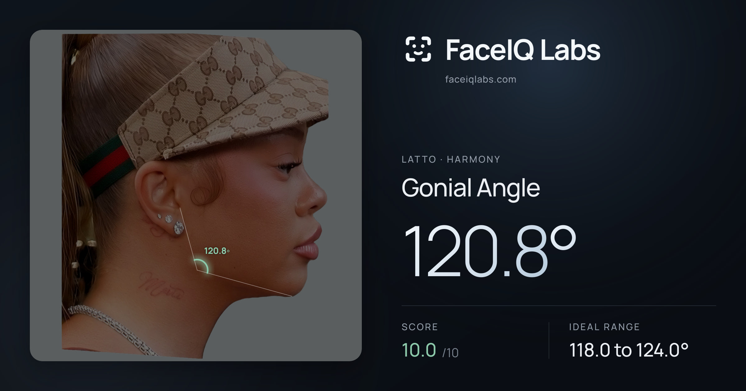 Latto Gonial Angle: 120.8°, drawn on the photo