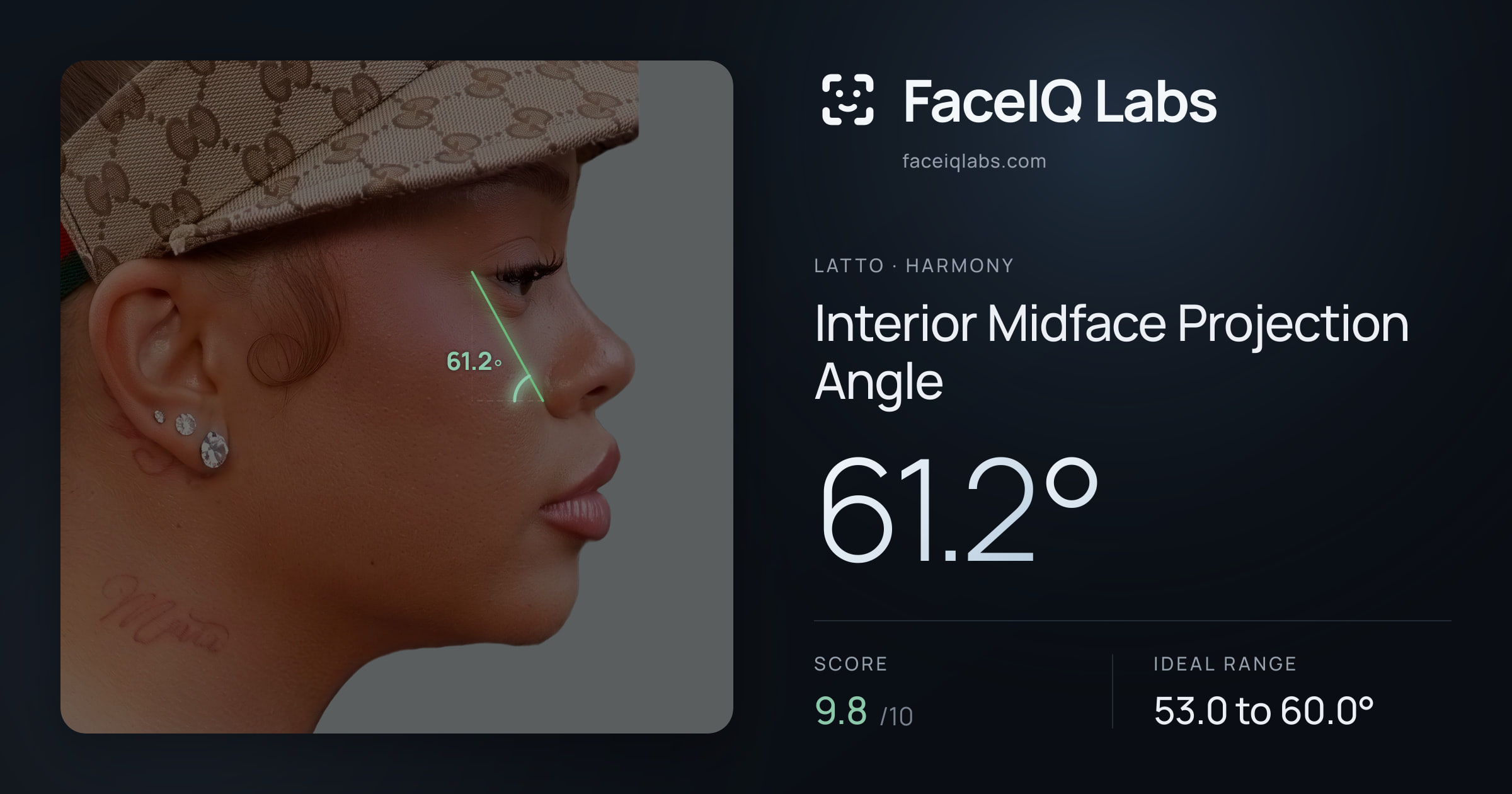 Latto Interior Midface Projection Angle: 61.2°, drawn on the photo