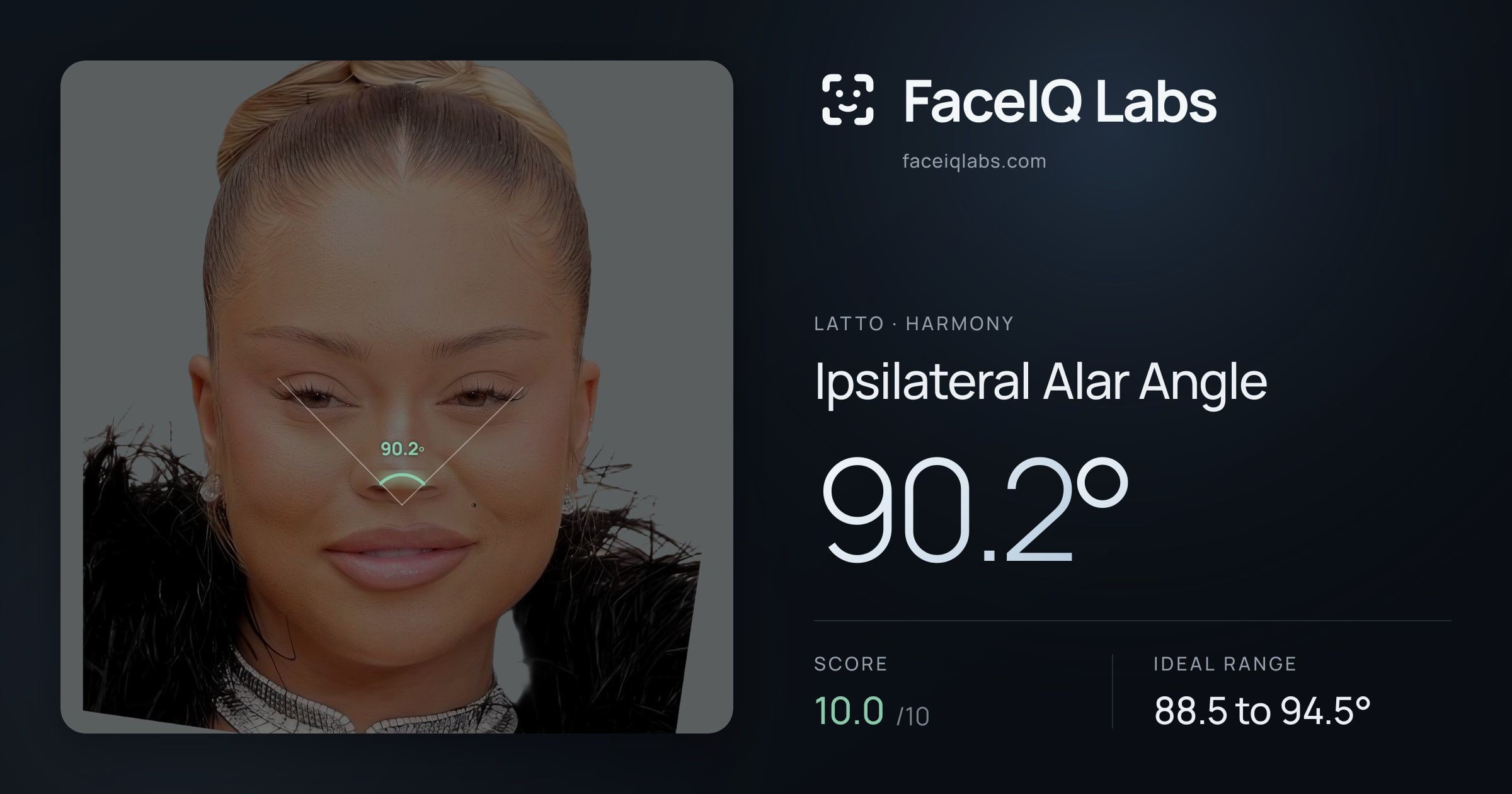 Latto Ipsilateral Alar Angle: 90.2°, drawn on the photo