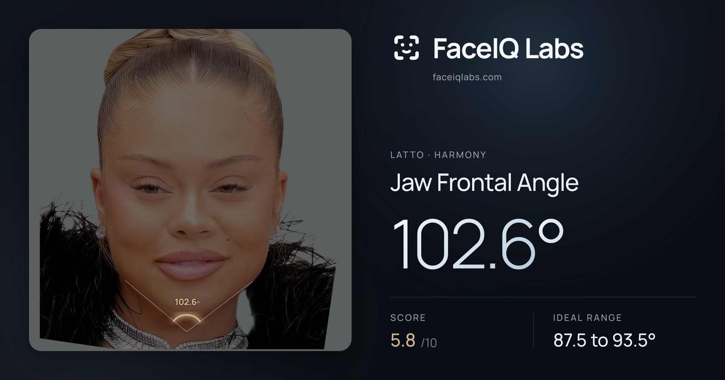 Latto Jaw Frontal Angle: 102.6°, drawn on the photo