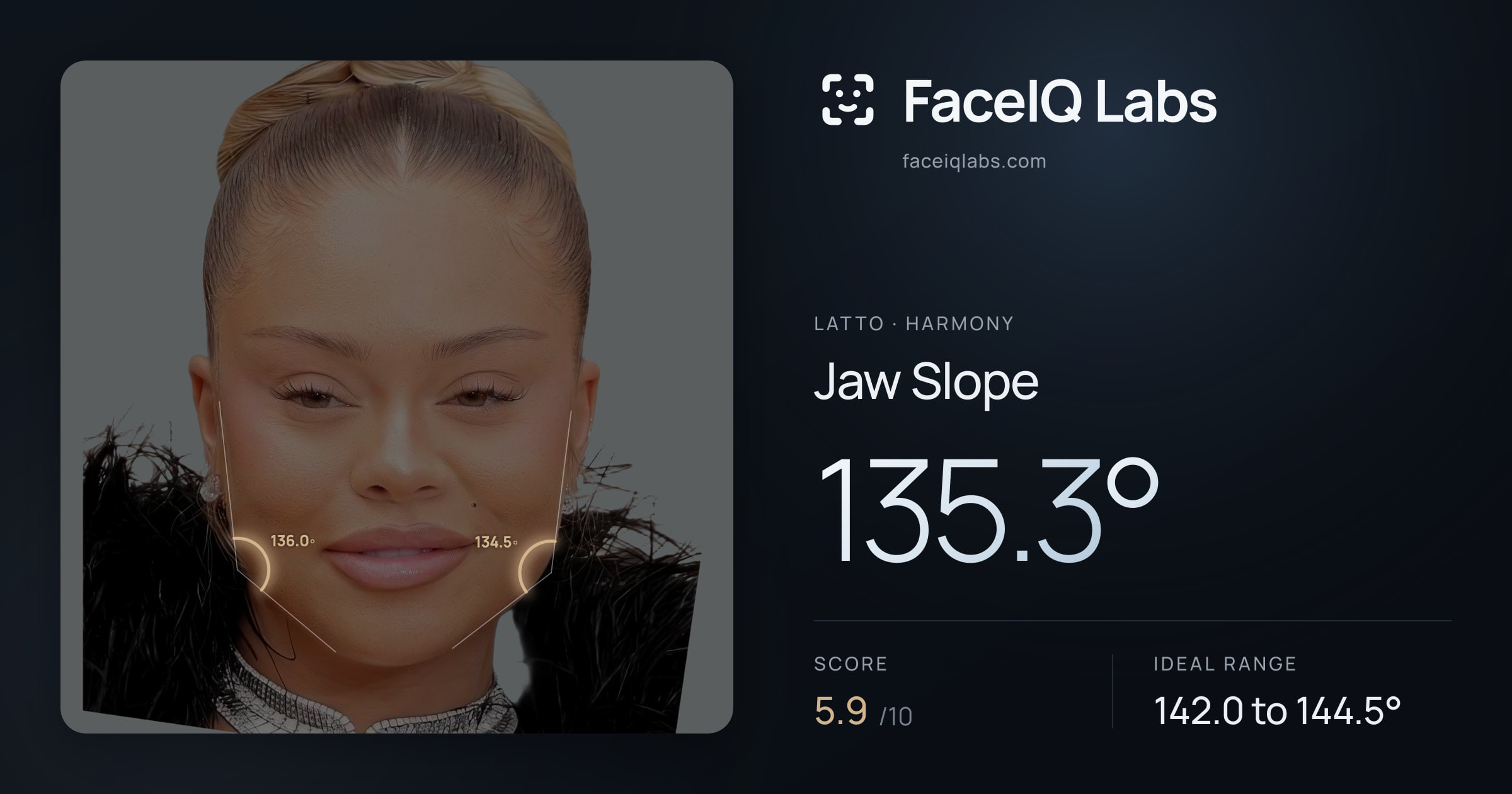 Latto Jaw Slope: 135.3°, drawn on the photo