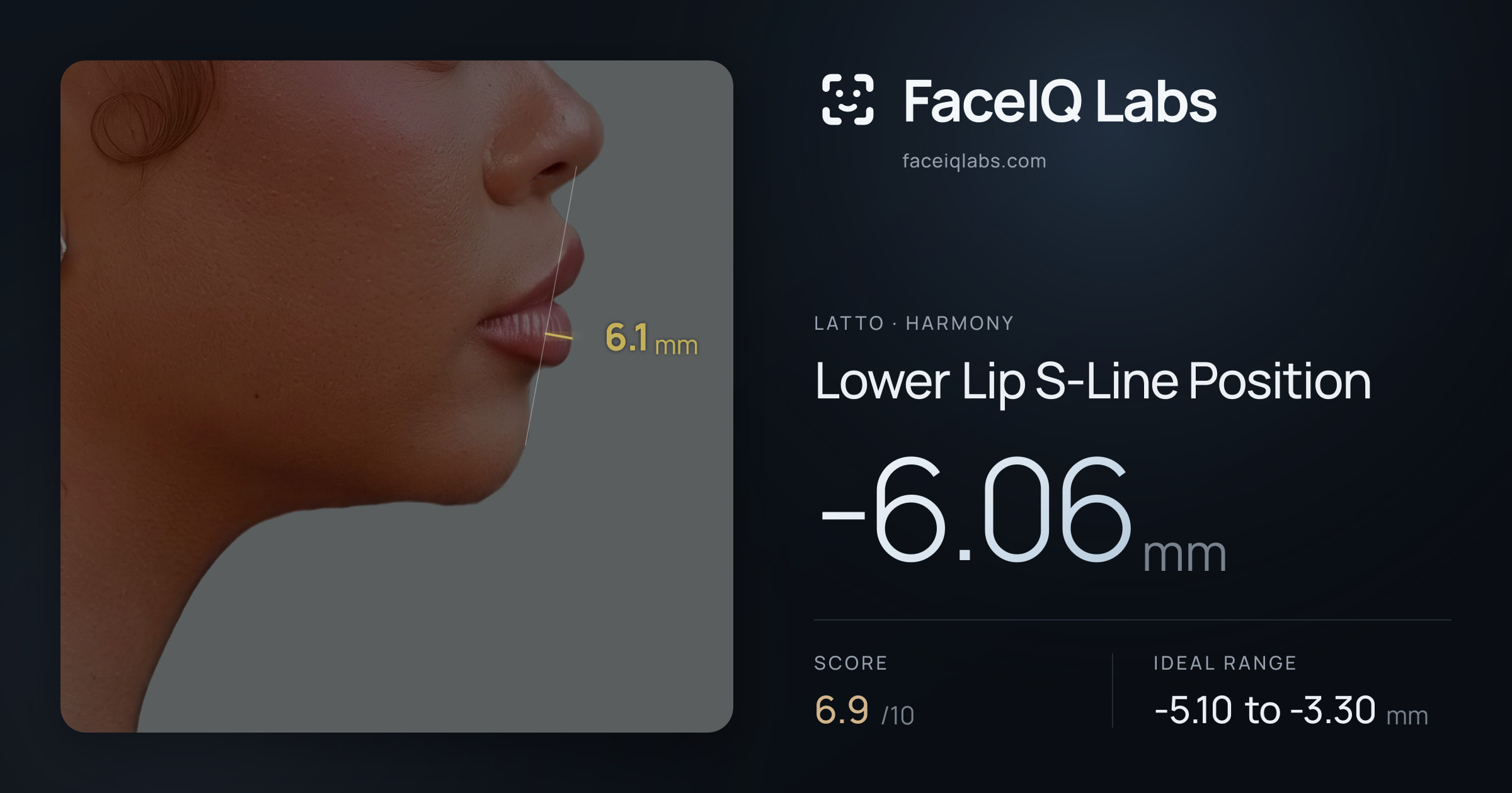Latto Lower Lip S-Line Position: -6.06mm, drawn on the photo