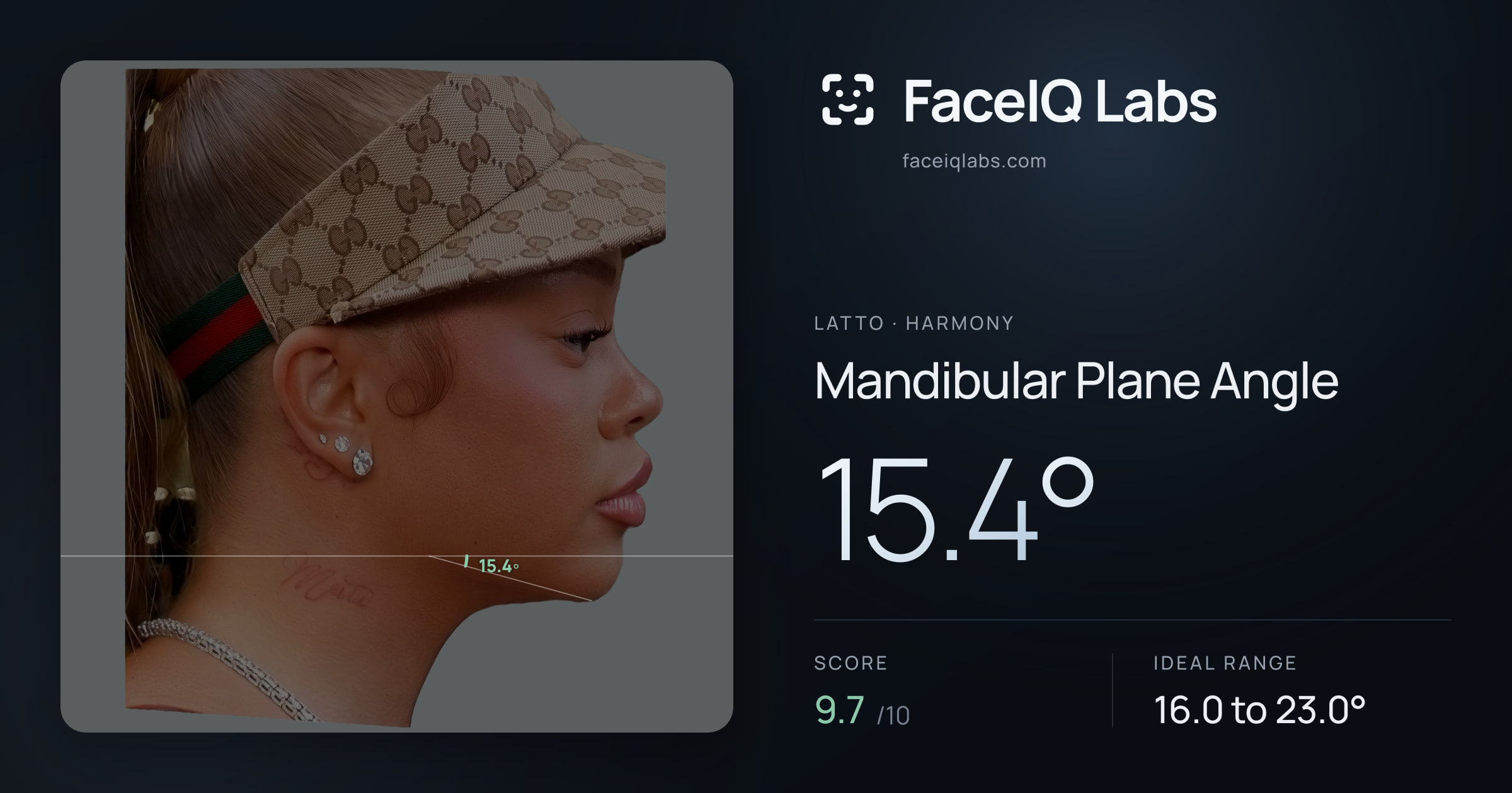 Latto Mandibular Plane Angle: 15.4°, drawn on the photo
