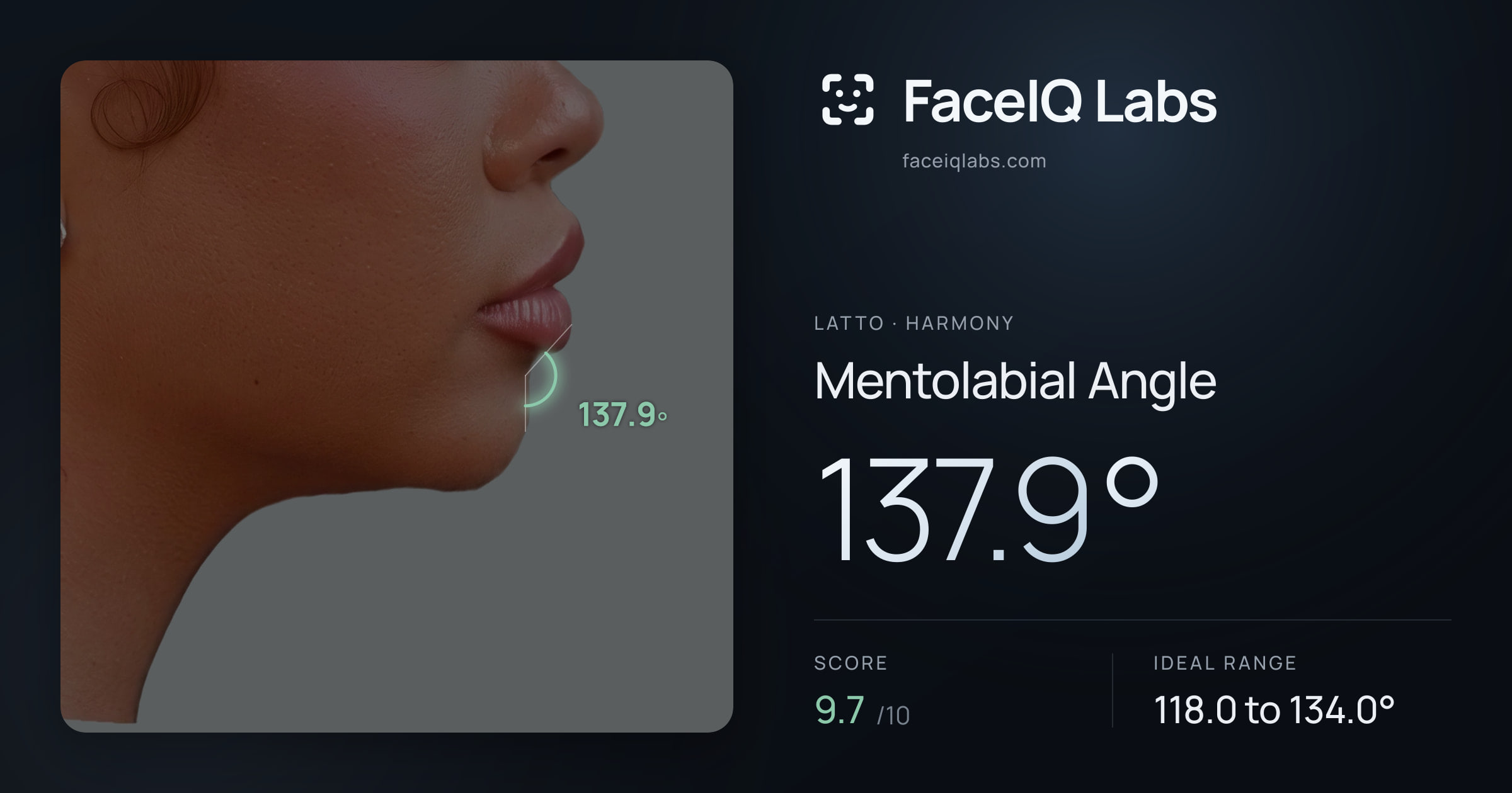 Latto Mentolabial Angle: 137.9°, drawn on the photo