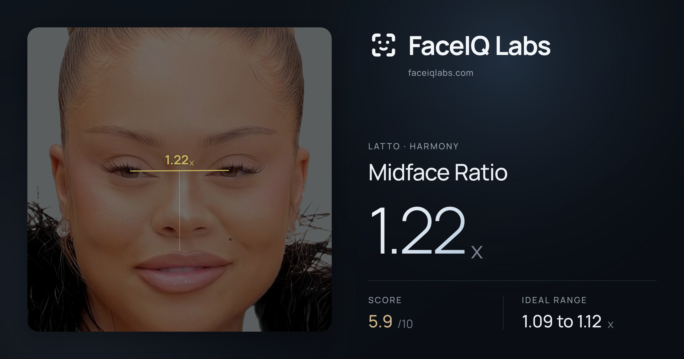 Latto Midface Ratio: 1.22x, drawn on the photo