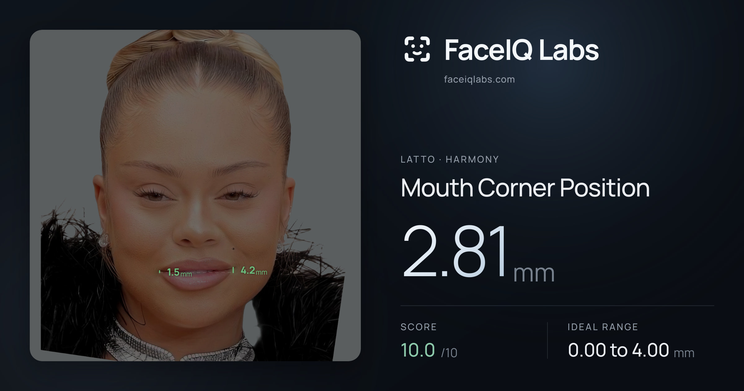 Latto Mouth Corner Position: 2.81mm, drawn on the photo