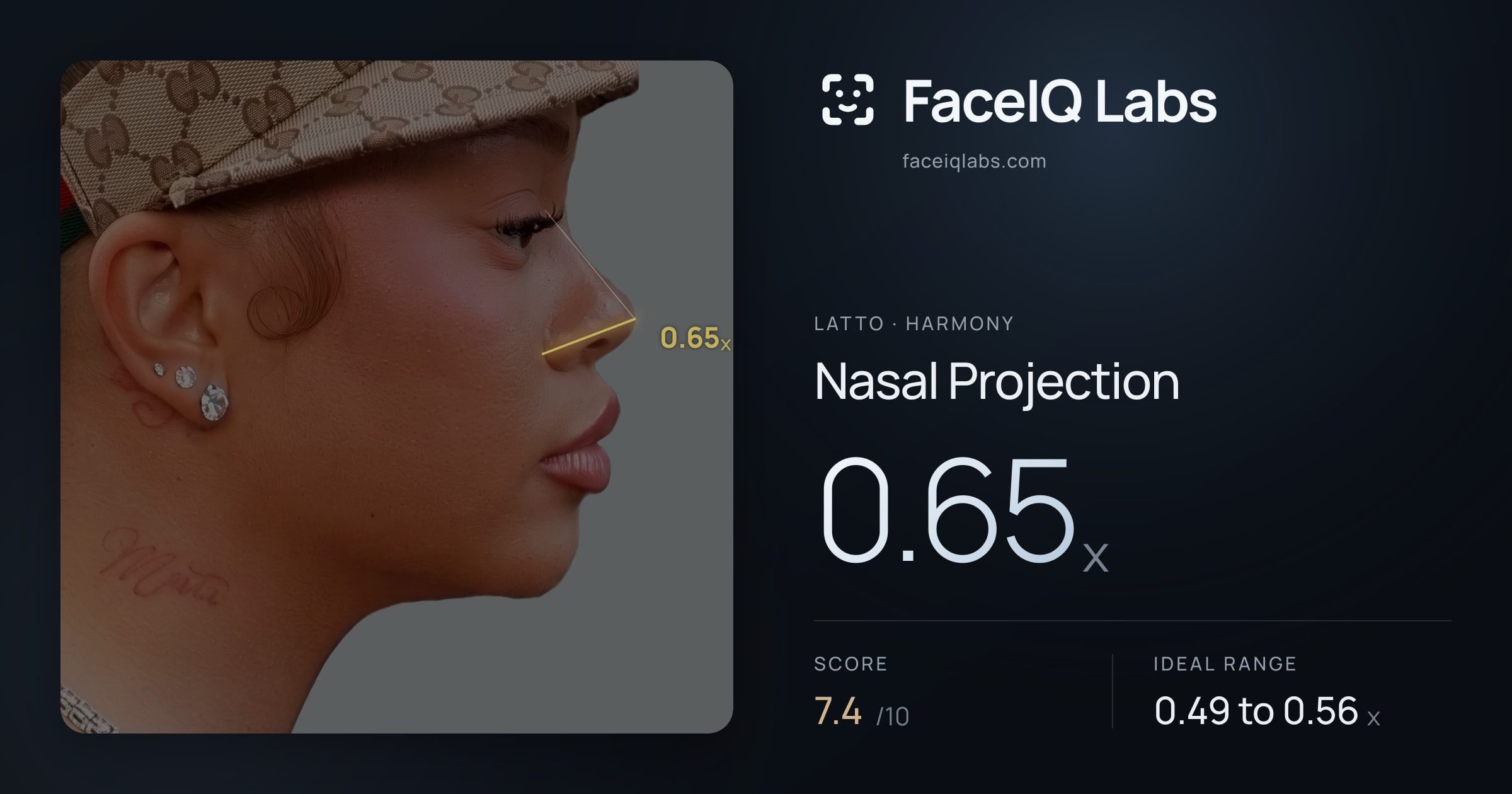 Latto Nasal Projection: 0.65x, drawn on the photo