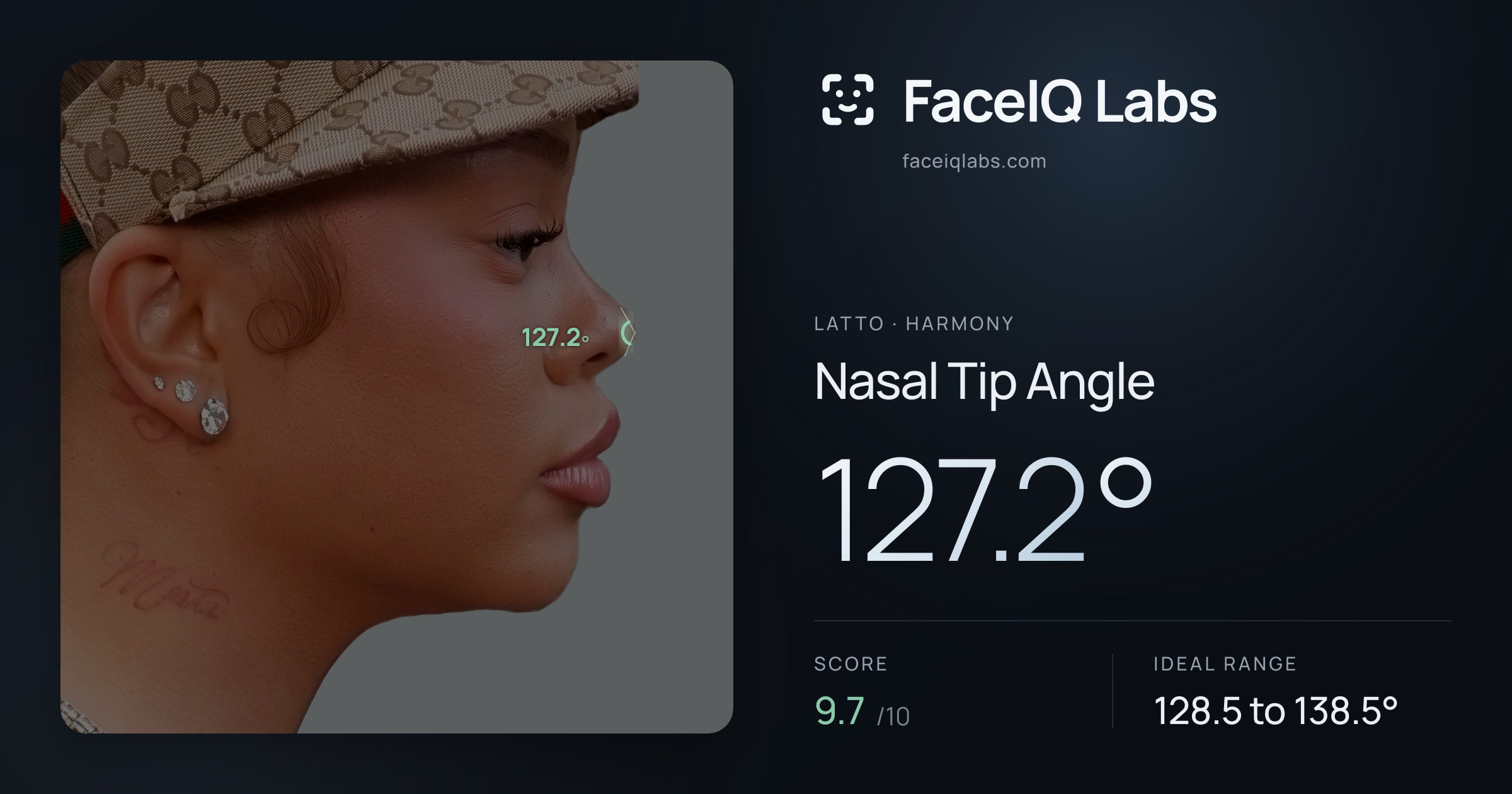 Latto Nasal Tip Angle: 127.2°, drawn on the photo