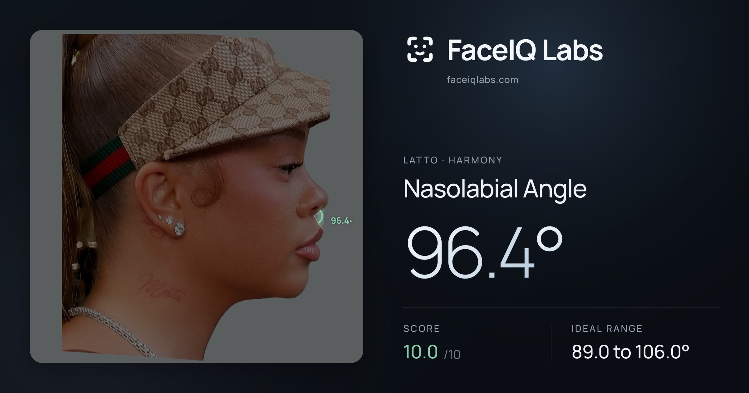 Latto Nasolabial Angle: 96.4°, drawn on the photo