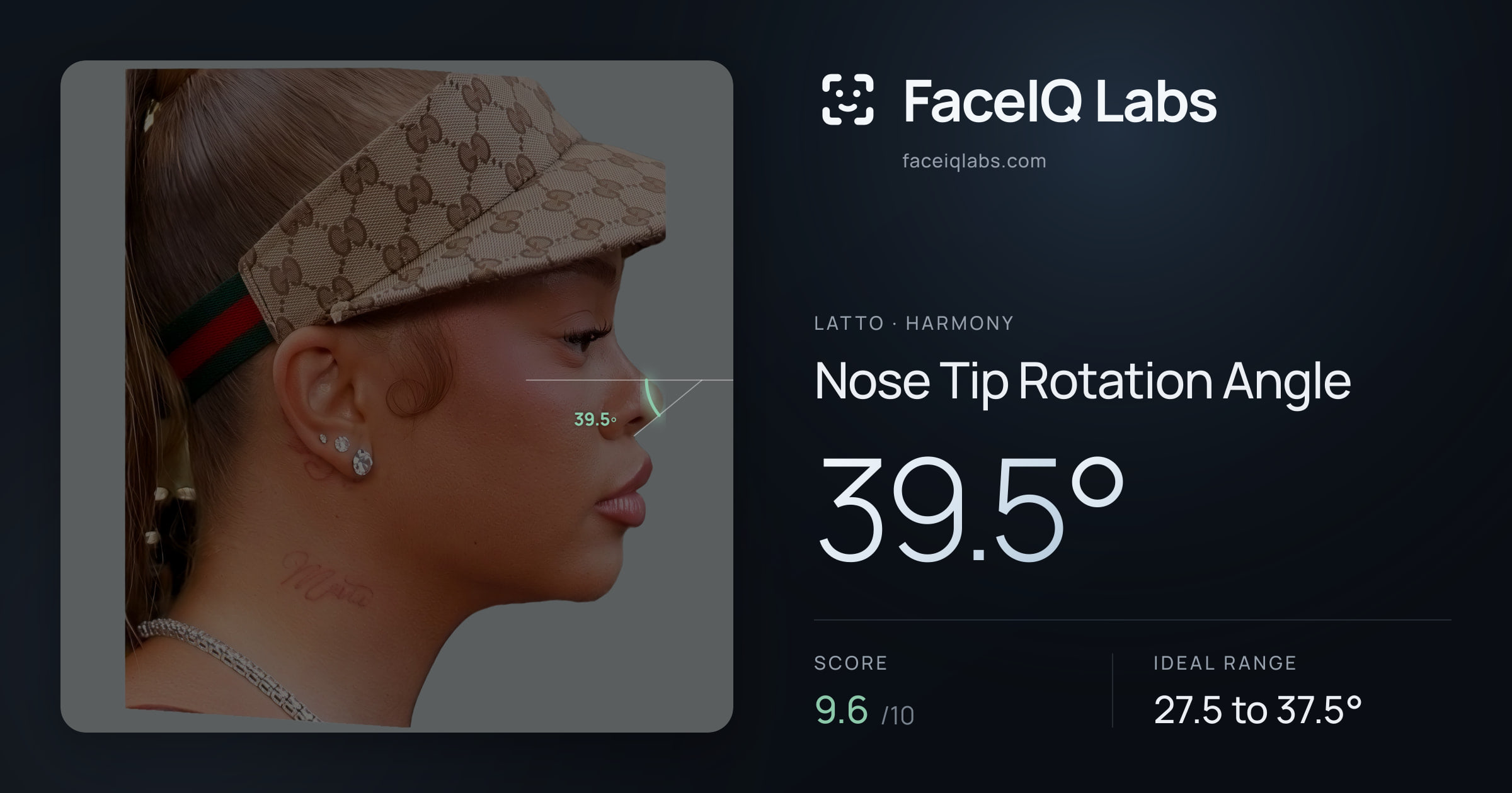 Latto Nose Tip Rotation Angle: 39.5°, drawn on the photo
