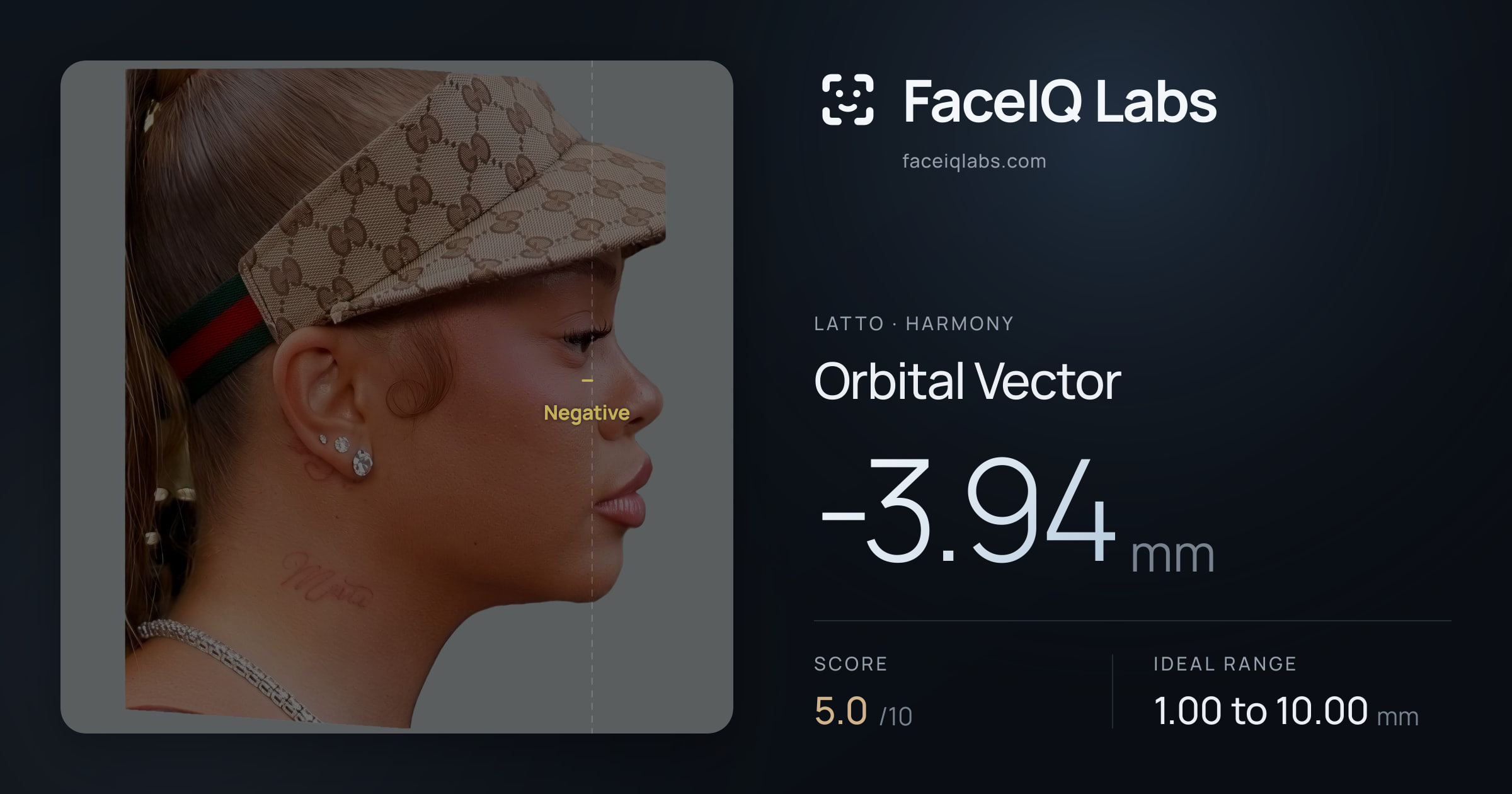 Latto Orbital Vector: -3.94mm, drawn on the photo