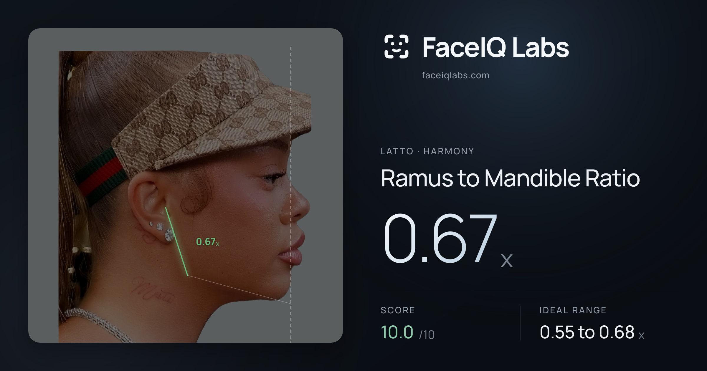 Latto Ramus to Mandible Ratio: 0.67x, drawn on the photo