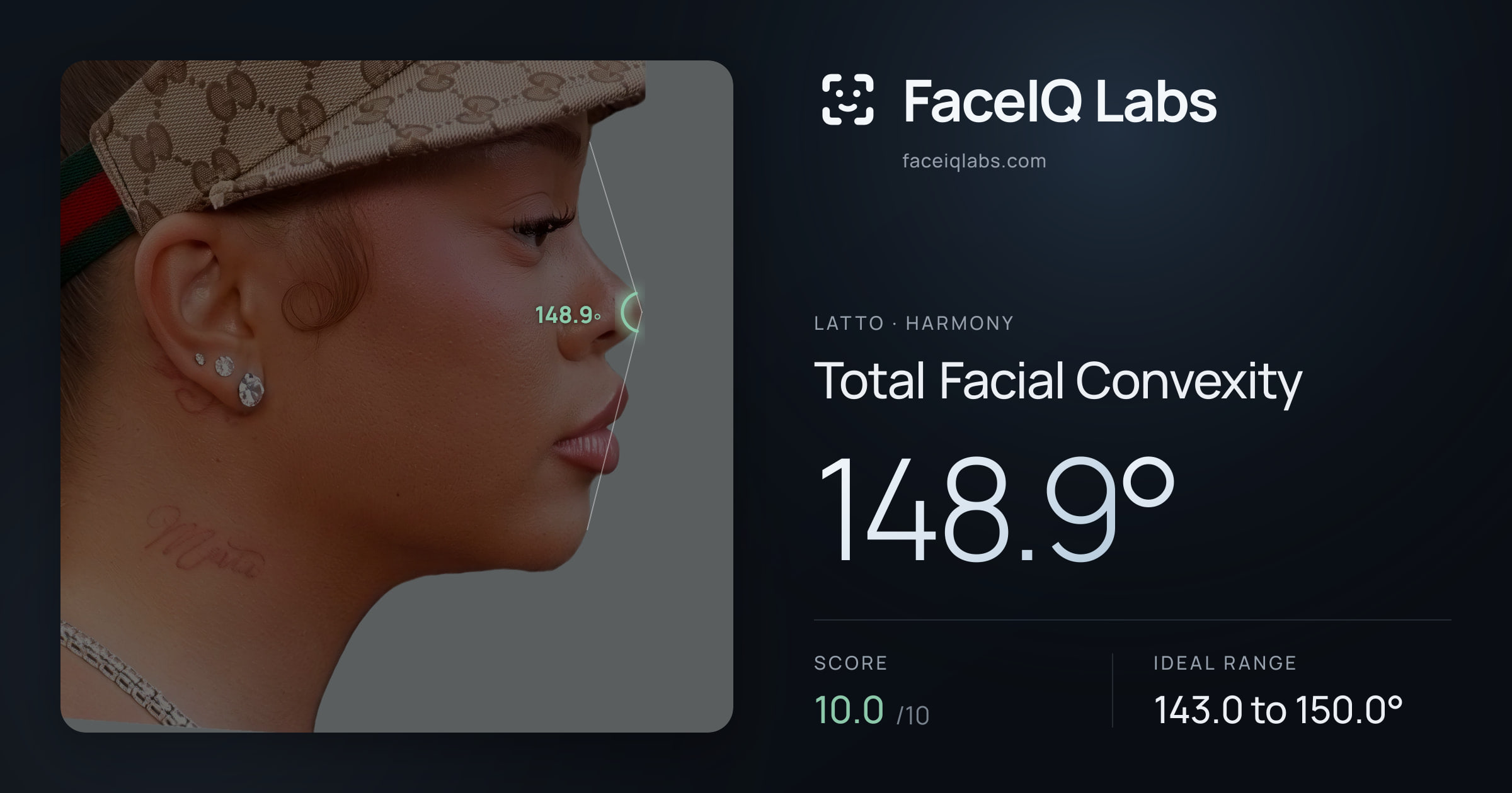 Latto Total Facial Convexity: 148.9°, drawn on the photo