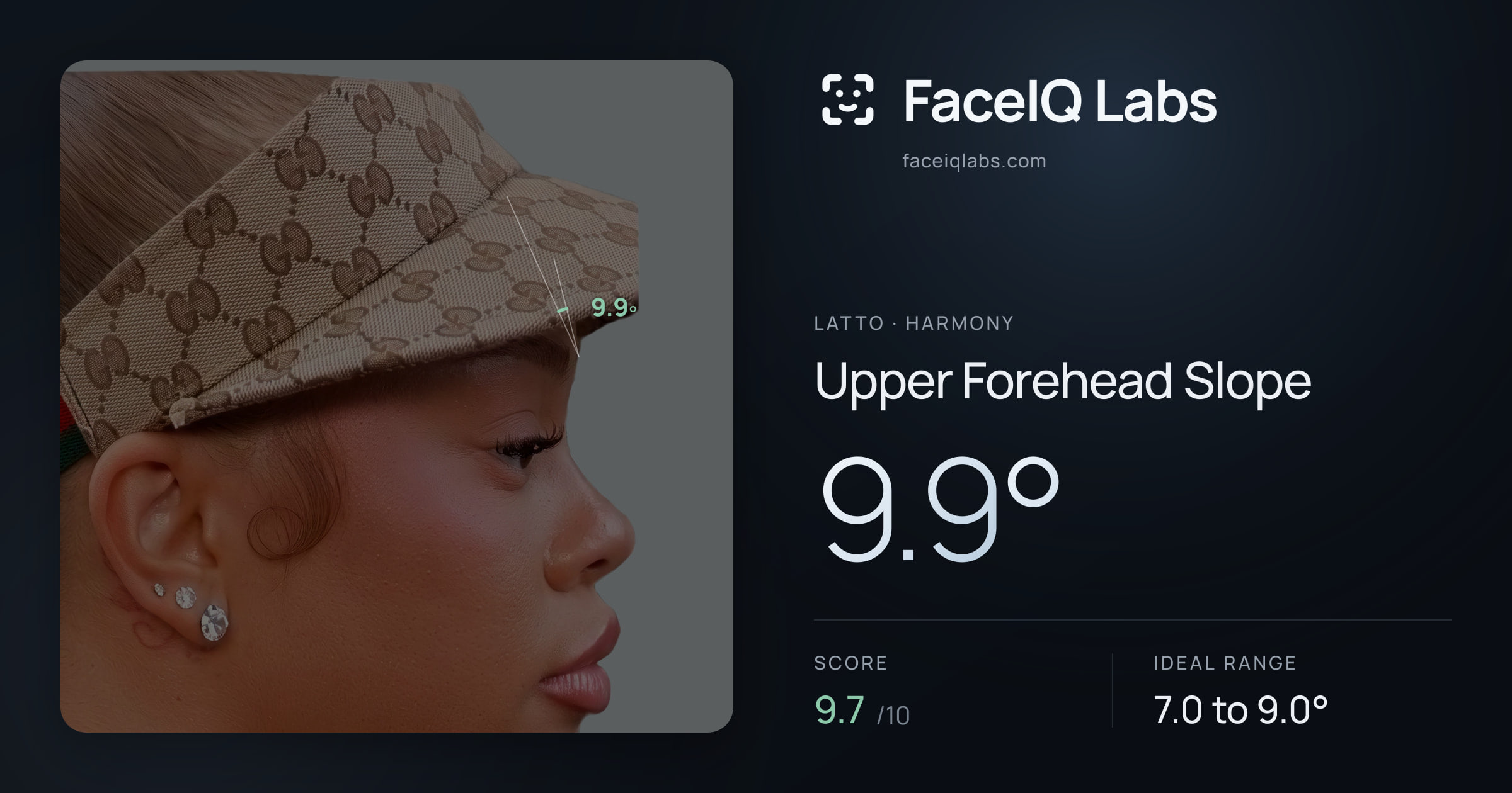 Latto Upper Forehead Slope: 9.9°, drawn on the photo
