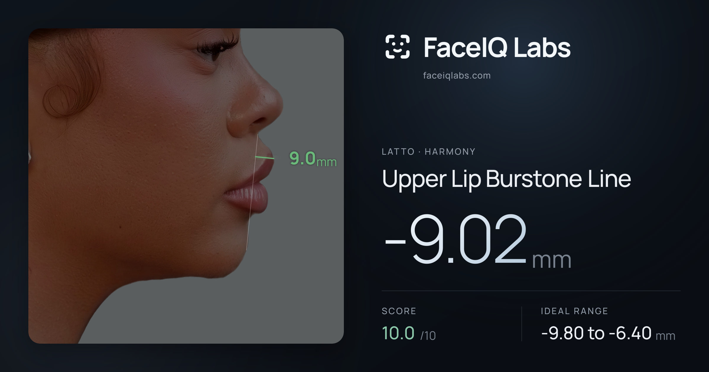 Latto Upper Lip Burstone Line: -9.02mm, drawn on the photo