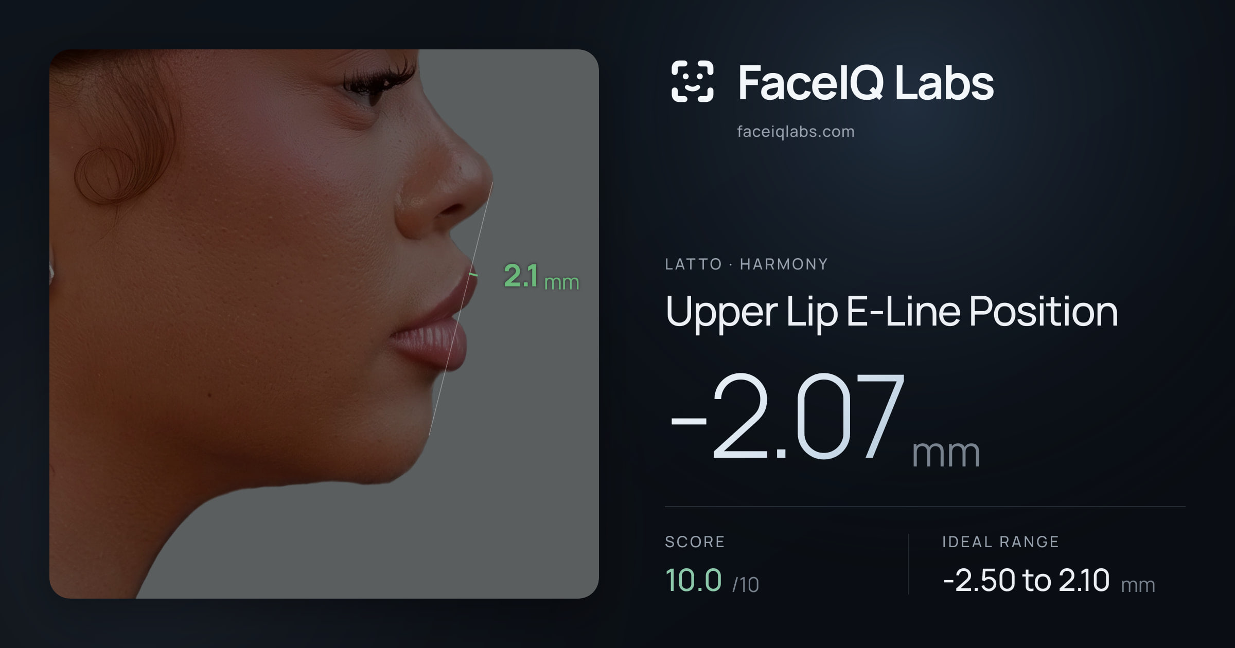 Latto Upper Lip E-Line Position: -2.07mm, drawn on the photo
